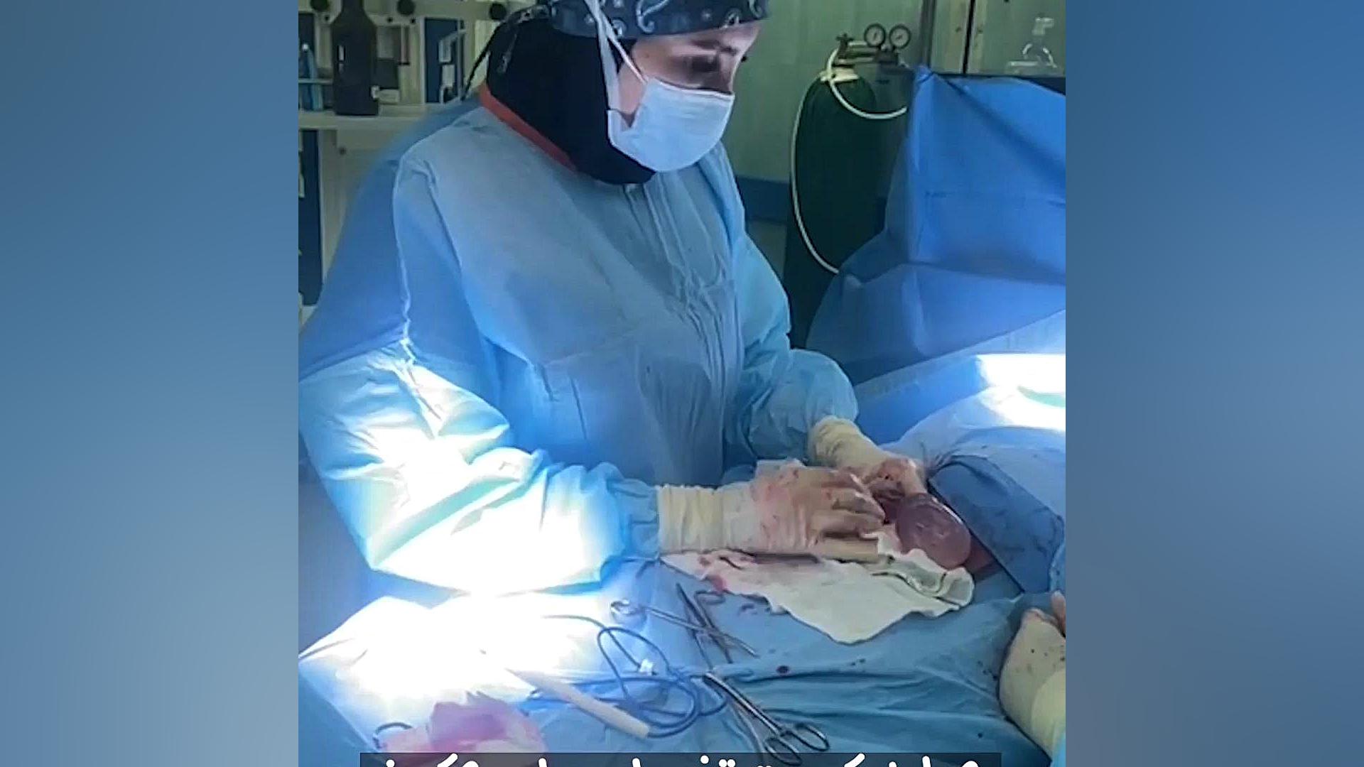 عمل کیست تخمدان دکتر زهره امیری