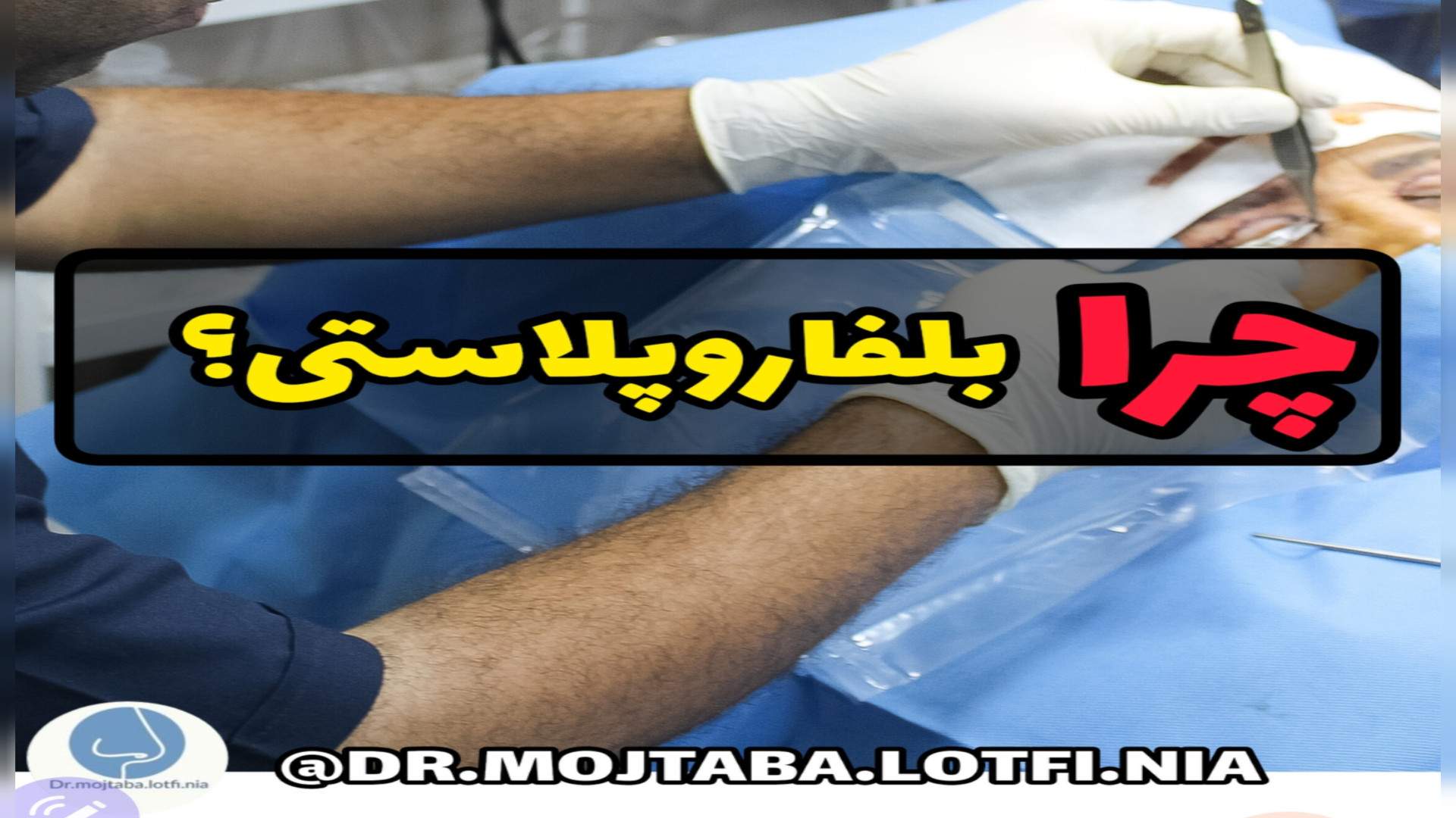 چرا بلفاروپلاستی؟؟؟ پلتفرم ارگانوئید انسانی