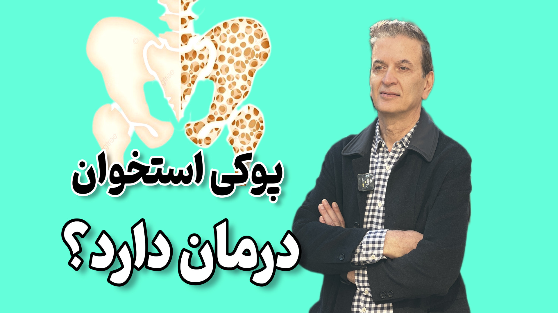 پوکی استخوان درمان دارد؟ دکتر محمود جعفر بیگلو