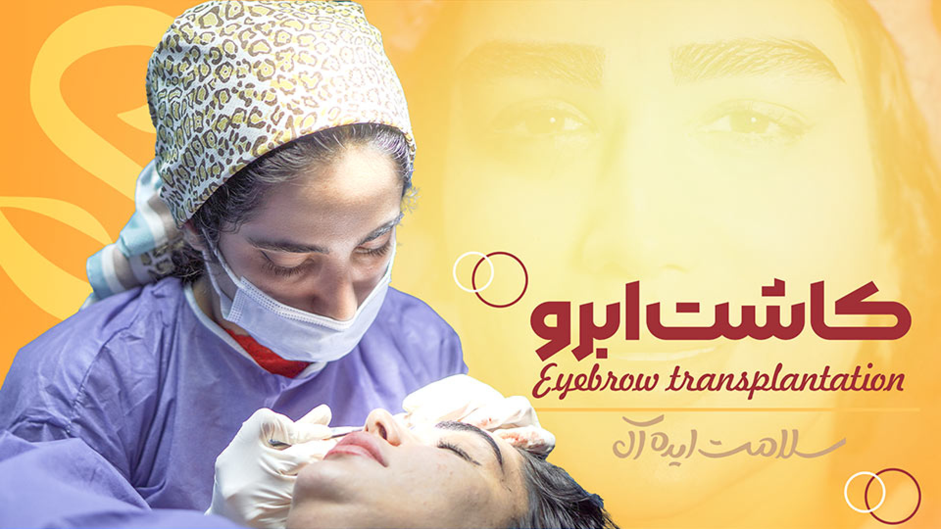 جراحی کاشت ابرو؛ اثری ماندگار و طبیعی بیماری نوری آسیب ارثی