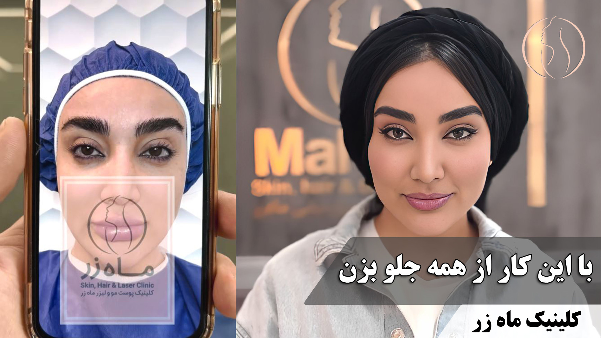 با این کار از همه جلو بزن ( کلینیک زیبایی ماه زر ) ترومبوسیتوپنی مقاوم