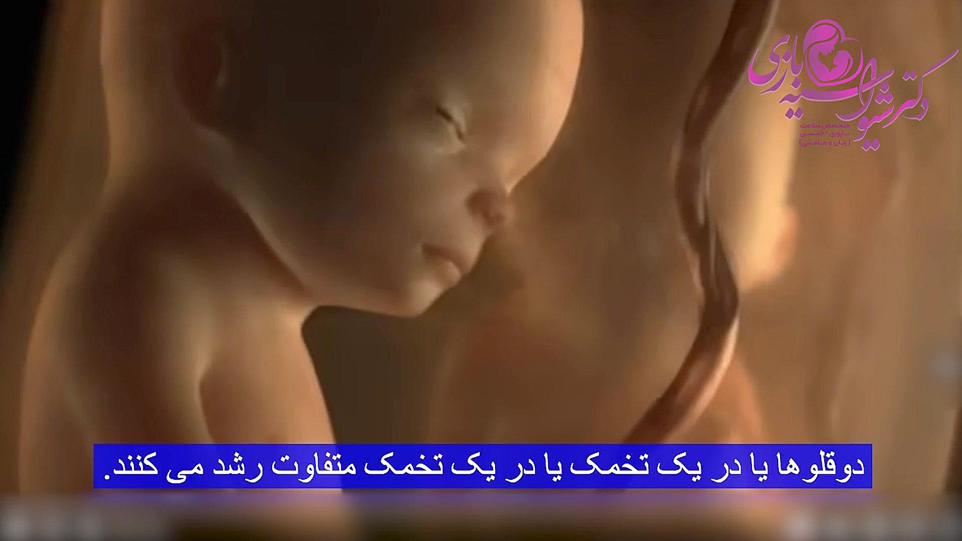 تشکیل جنین دوقلو دکتر شیوا سیه بازی