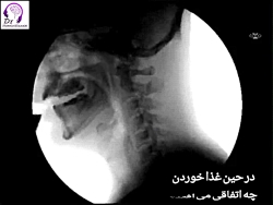 آناتومی بلع