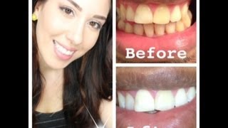 euthymol toothpaste before and after