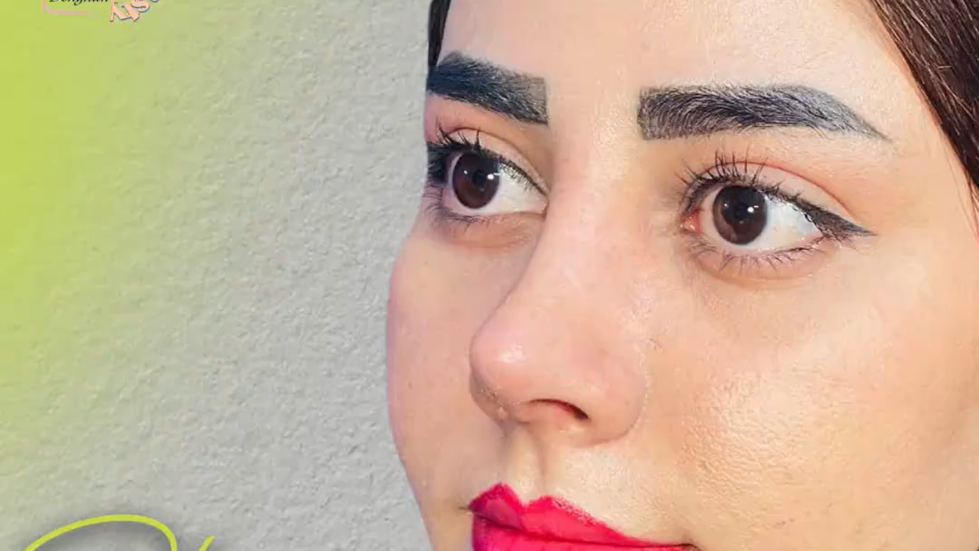 نتیجه جراحی بینی با دکتر الهام دهقان ترمیم سوختگی