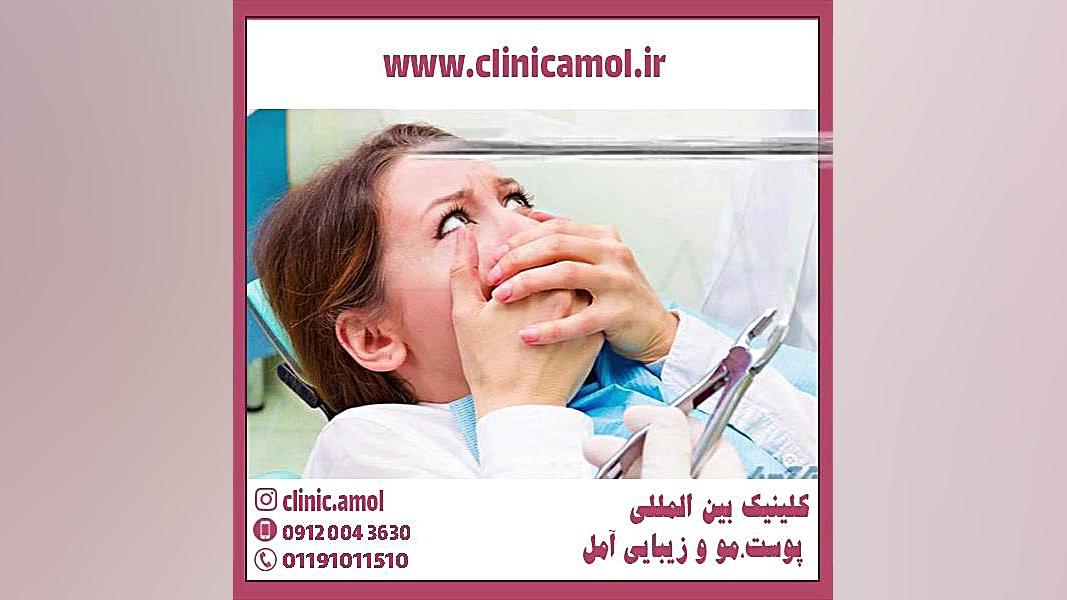 کشیدن دندان پوسیده PVRژنتیک پزشکی پیشرفته