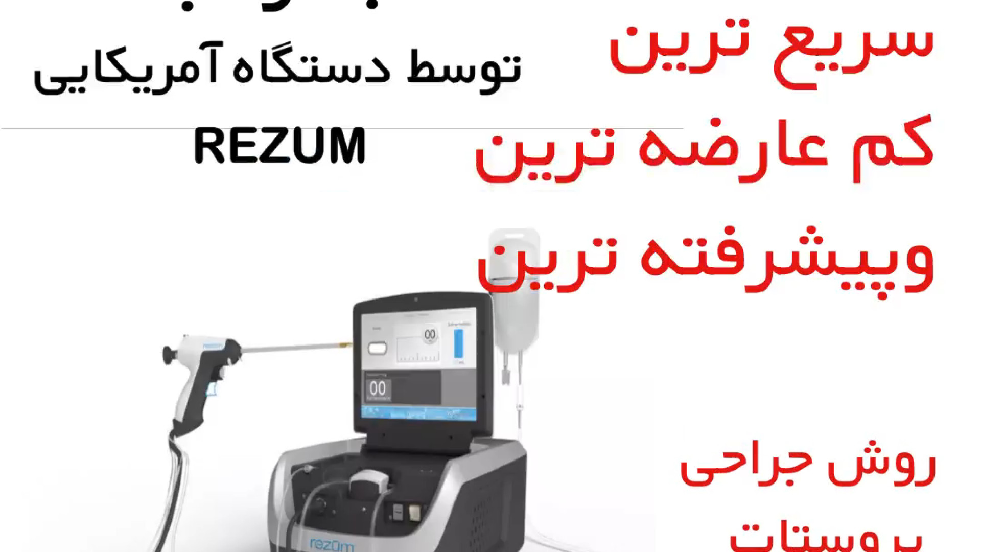 جدیدترین و بهترین روش درمان سرپایی پروستات با بخار آب جرمگیری