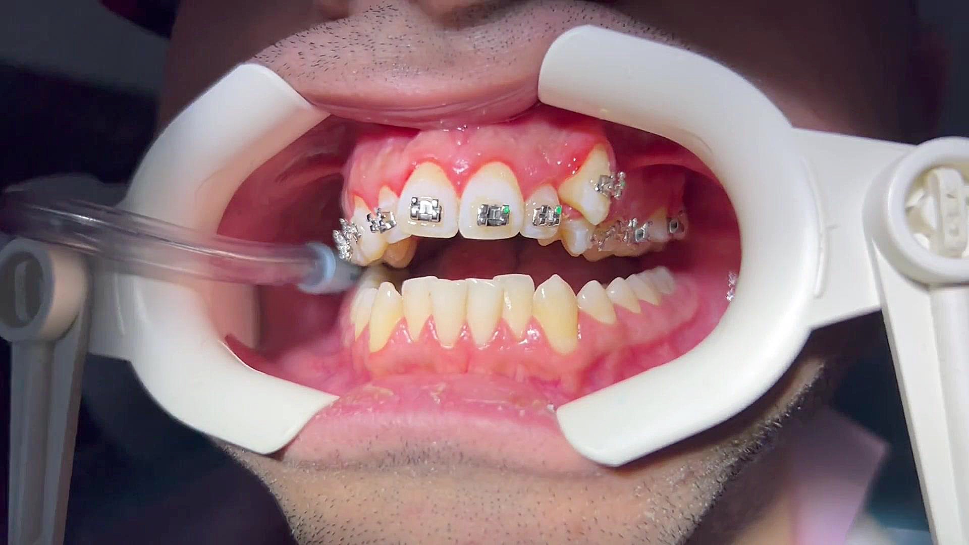 ارتودنسی دکتر مهدی فهیمی هنزائی دكتر مهدي فهيمي هنزائي