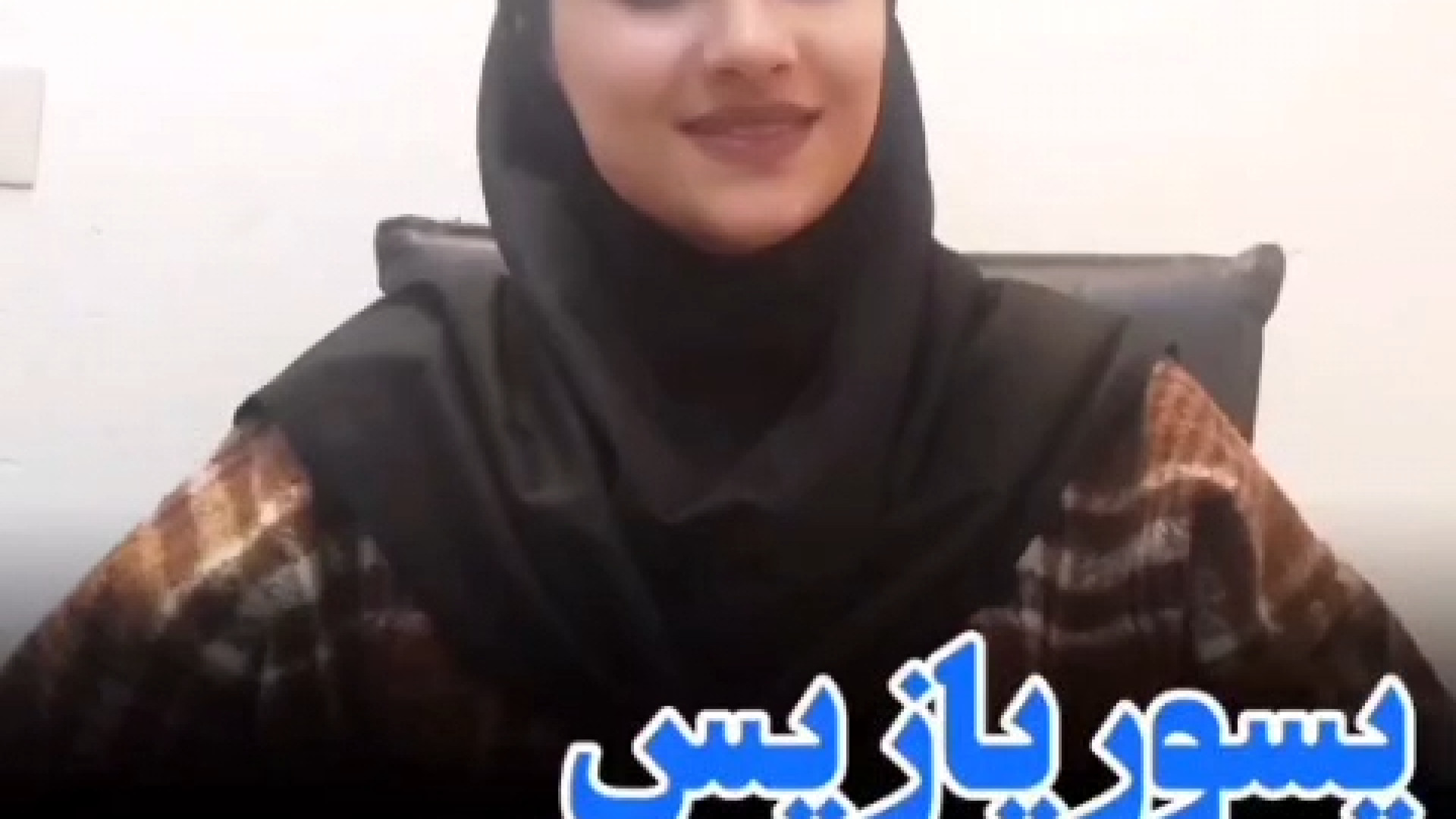 روماتیسم به پسوریازیس مربوط است. مراقب باشید Psoriasis آرتریت روماتوئید کاشت مو