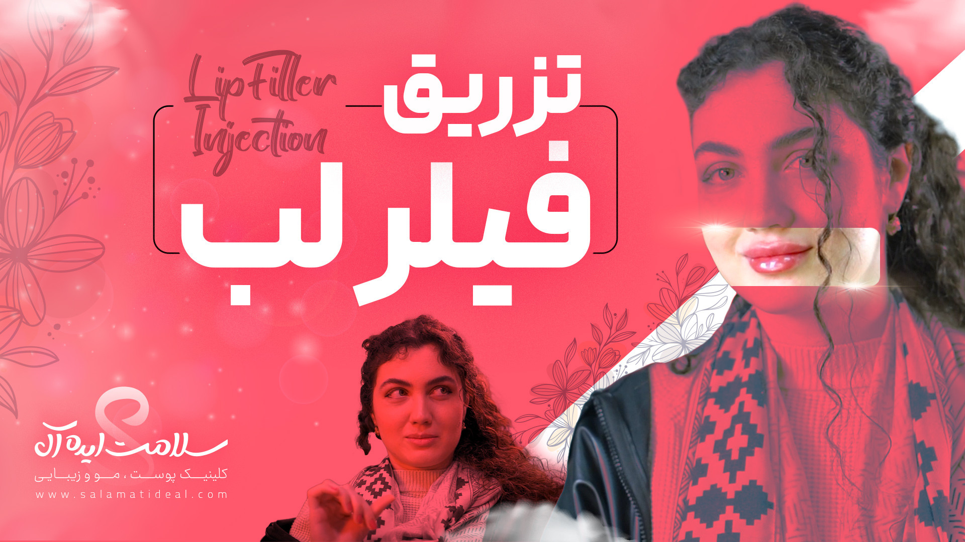 نتیجه تزریق ژل لب طبیعی توسط بهترین دکتر پوست و مو کپسول اندوسکوپی