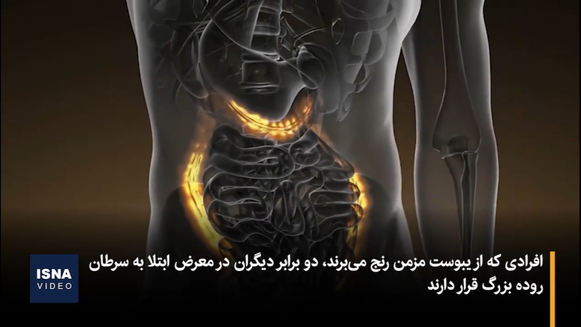 یک «اشتباه ساده» و خطر ابتلا به سرطان روده بزرگ لیپوساکشن
