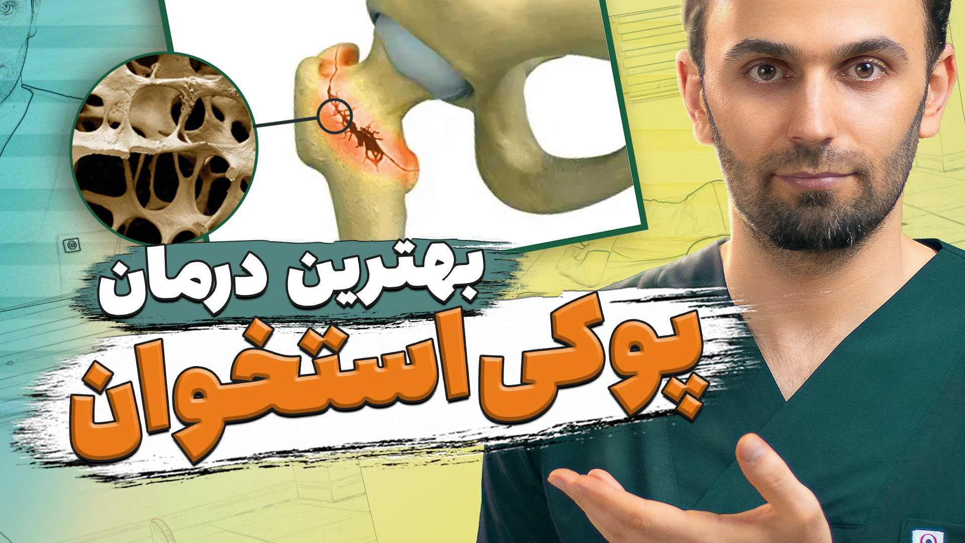 بهترین درمان پوکی استخوان لیفت ابرو