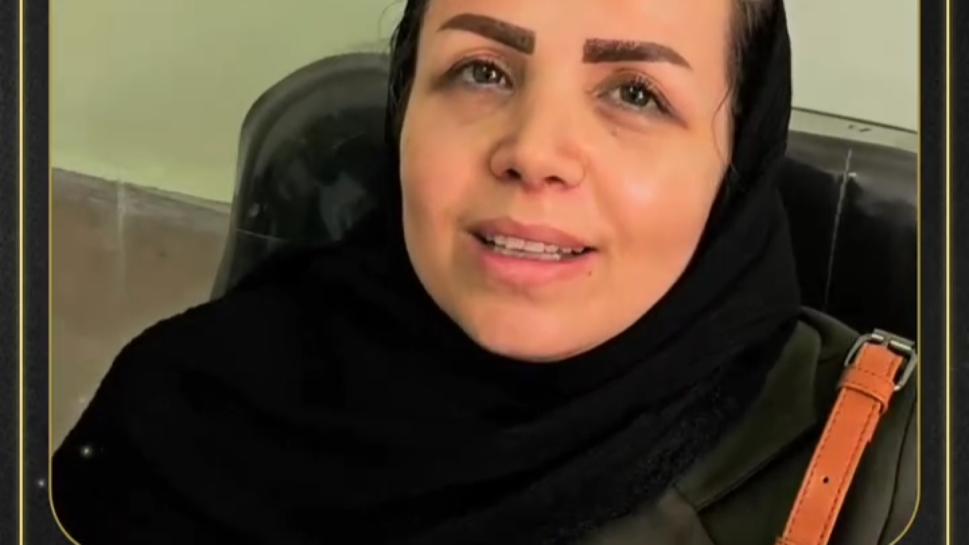 ️سپتورینوپلاستی بینی استخوانی با پوست نازک نوع بینی درخواستی زیبا جو:نچرال دکتر علی عقیلی - جراح بینی در تهران