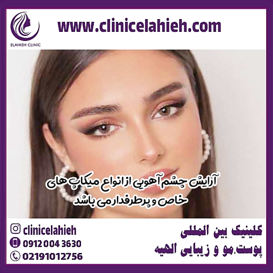 آرایش چشم