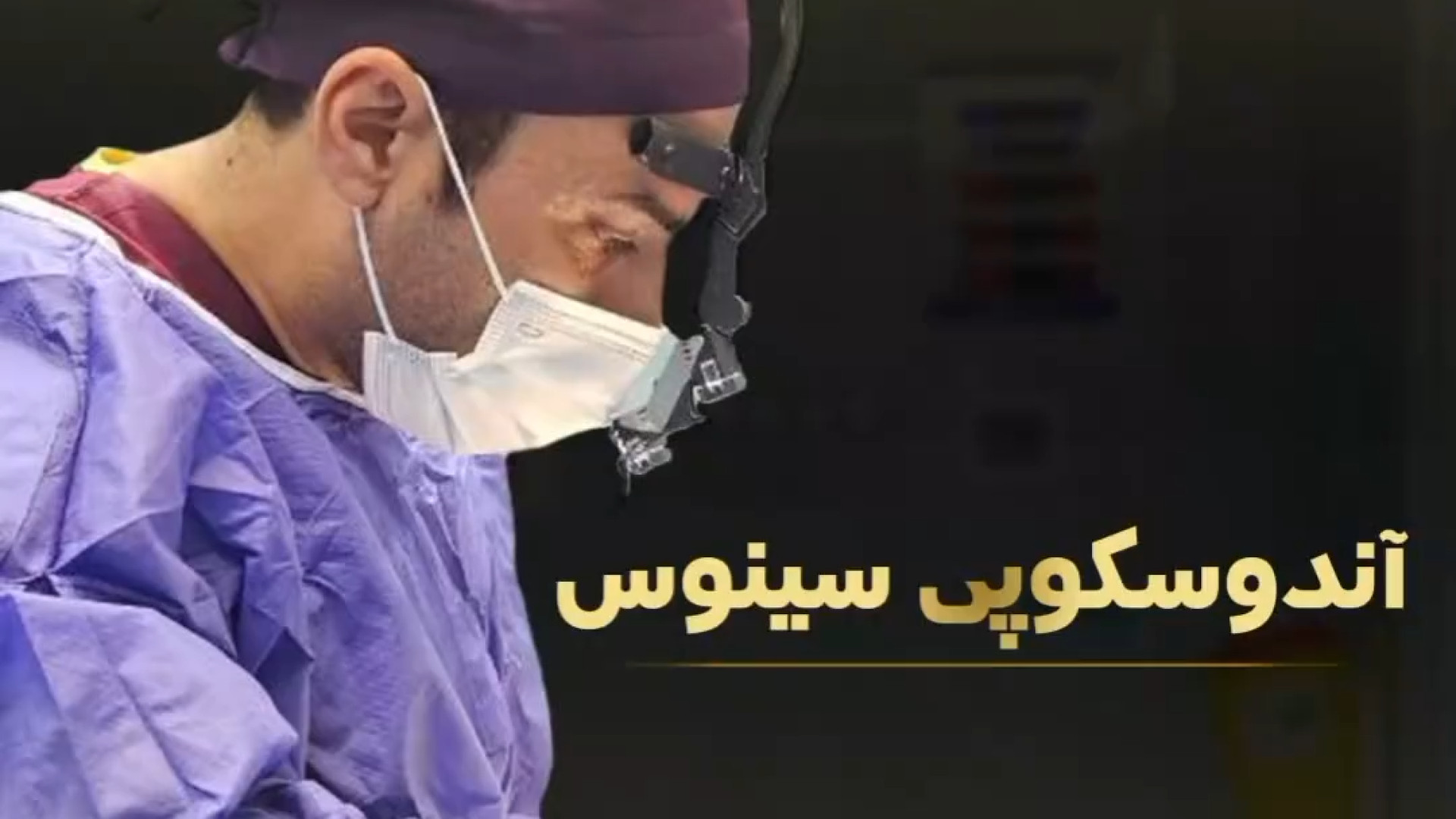 ️ آندوسکوپی سینوس همراه با دکتر عقیلی دکتر علی عقیلی - جراح بینی در تهران