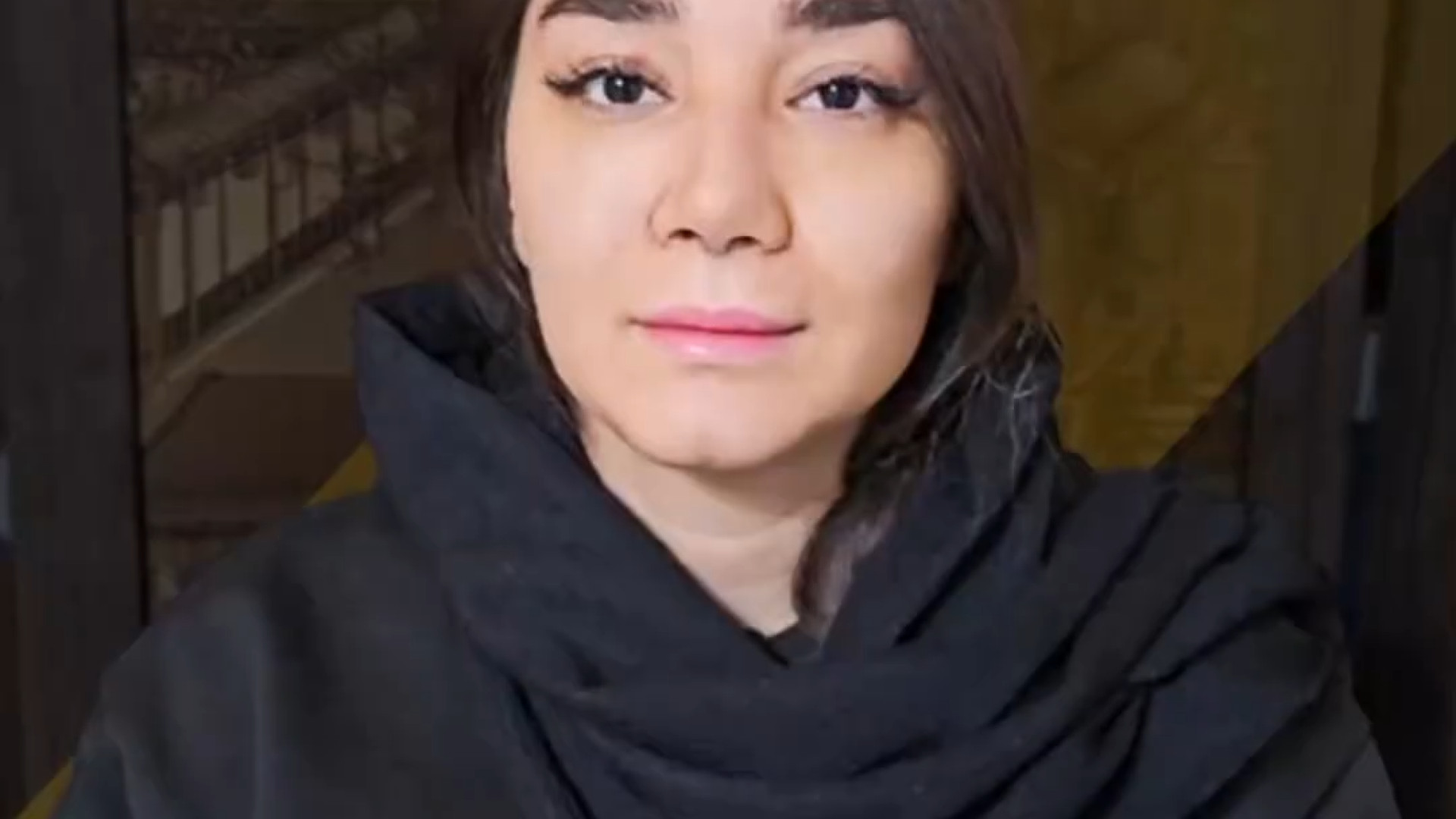 نتیجه جراحی بینی گوشتی و دارای انحراف دکتر علی عقیلی - جراح بینی در تهران