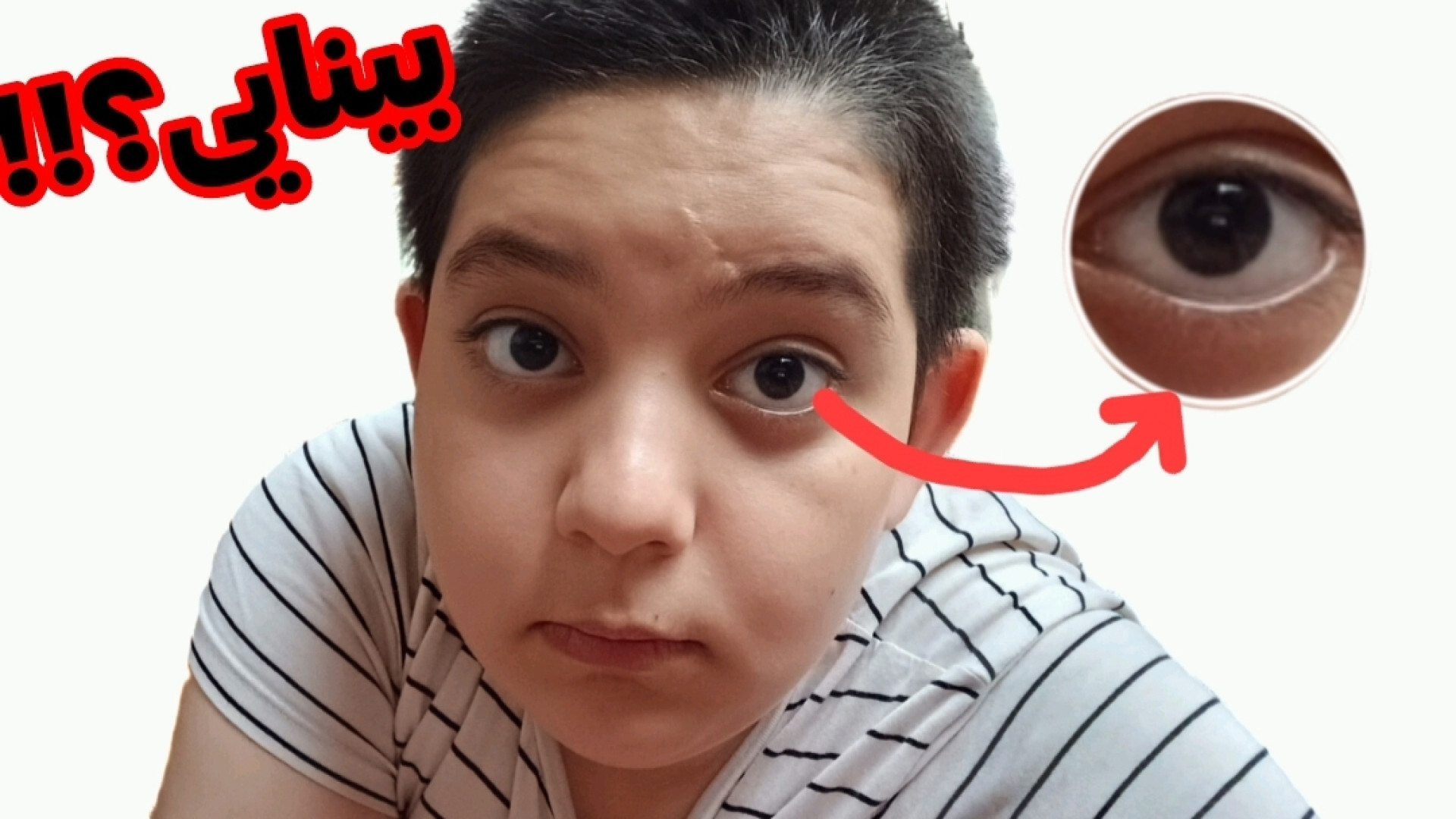 بینایی من چه طوریه؟؟ | تست بینایی دادم!! لیپوساکشن