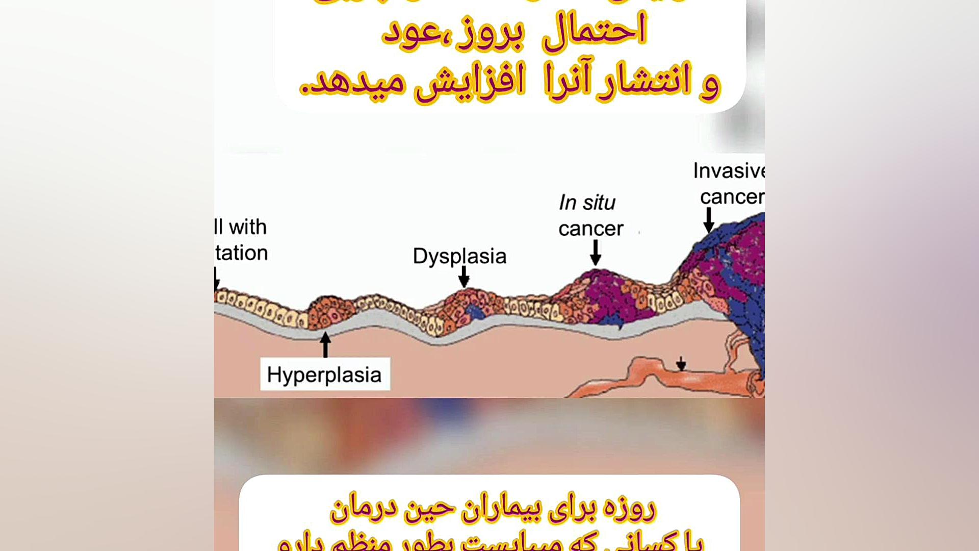 سرطان و روزه داری مجله آنکولوژی ( دکتر رضا )خدابخشی
