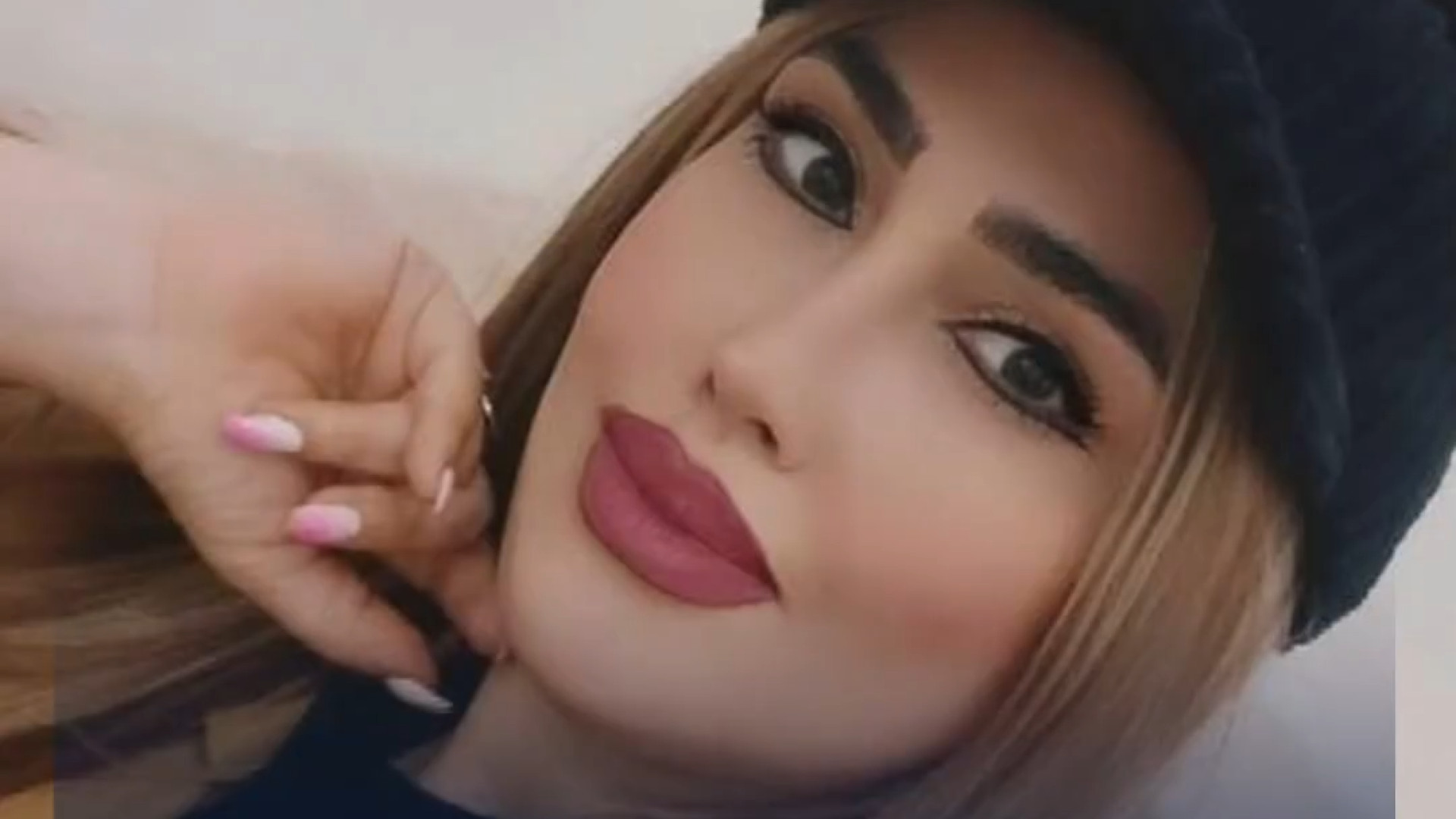 رضایت بیمار با عمل بینی با بیحسی موضعی | دکتر لاجوردی دندان مصنوعی