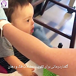 گفتاردرمانی در سندرم داون