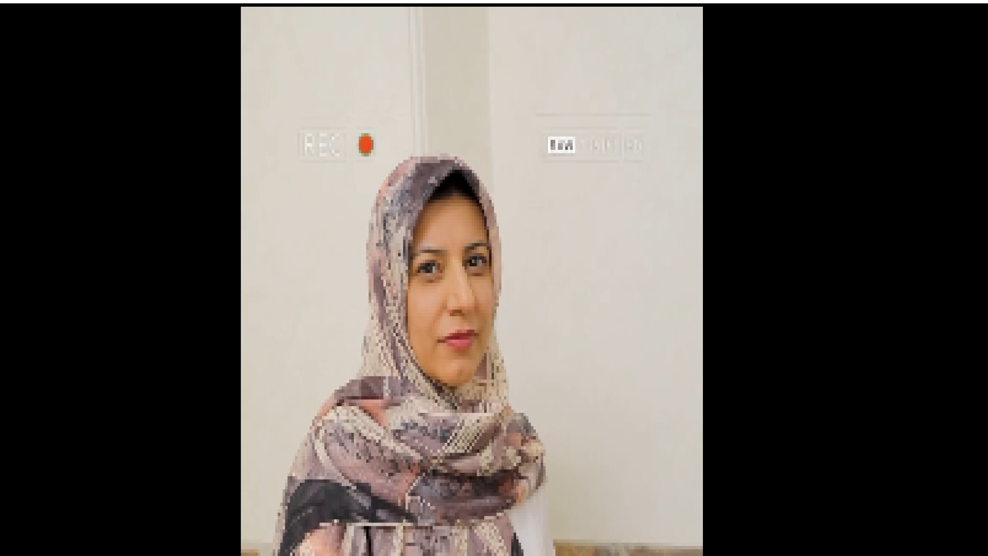 تعداد جلسات اندولیفت دکتر حمیده آقایی