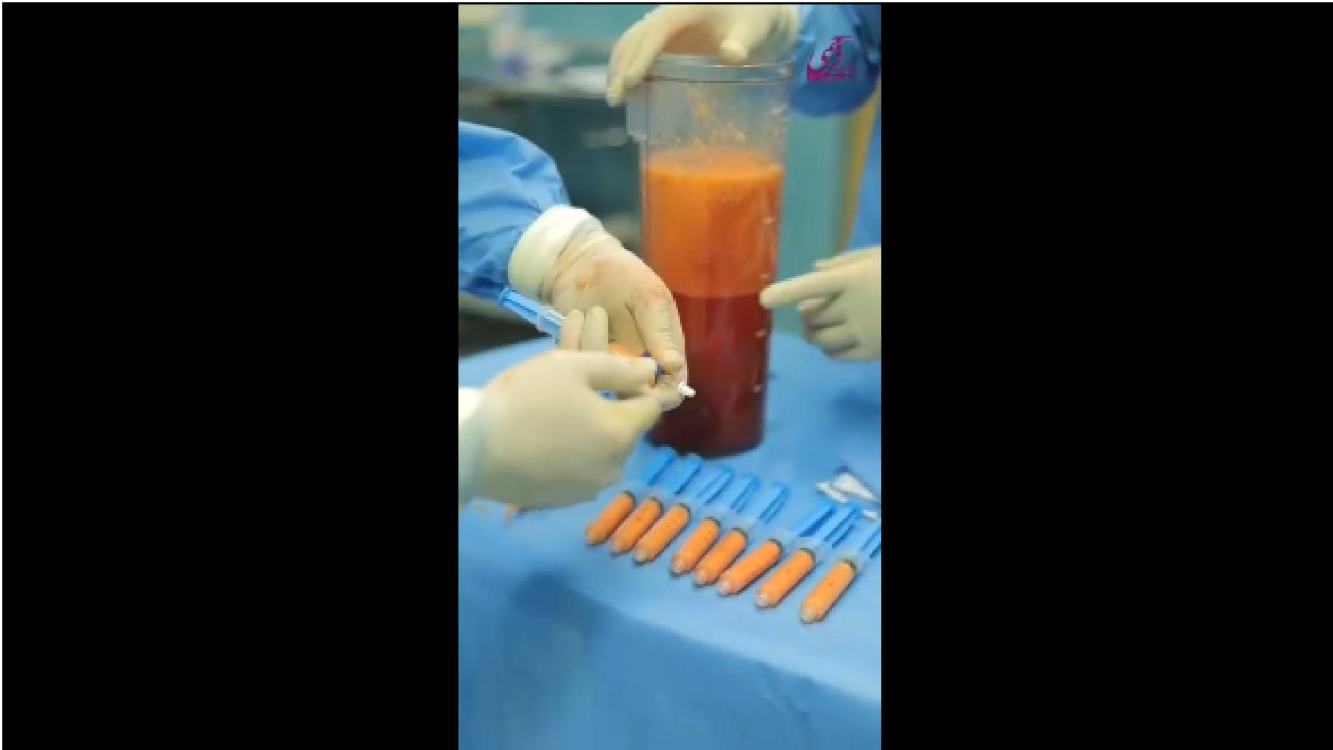 تزریق چربی به مچ پا انسریدا