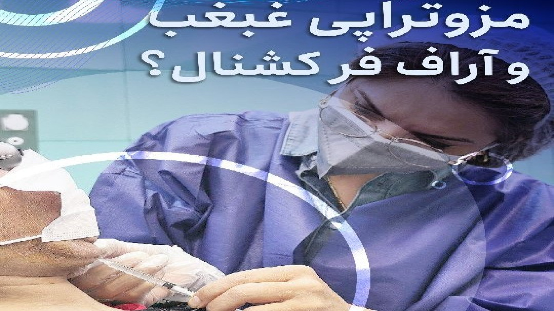 مزوتراپی غبغب و آراف فرکشنال سوزنی جهت رفع غبغب هایپوفلکسی