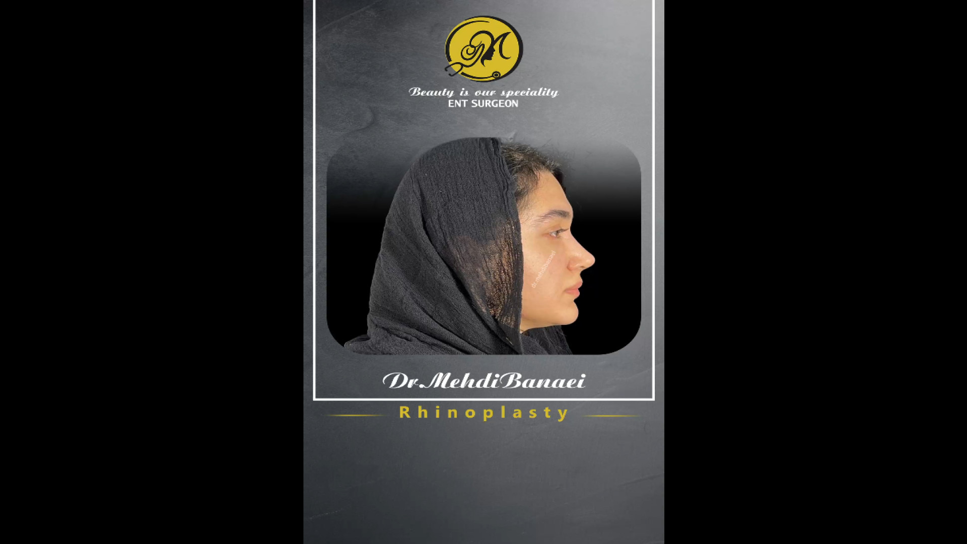 نگاهی به نتیجه جراحی بینی