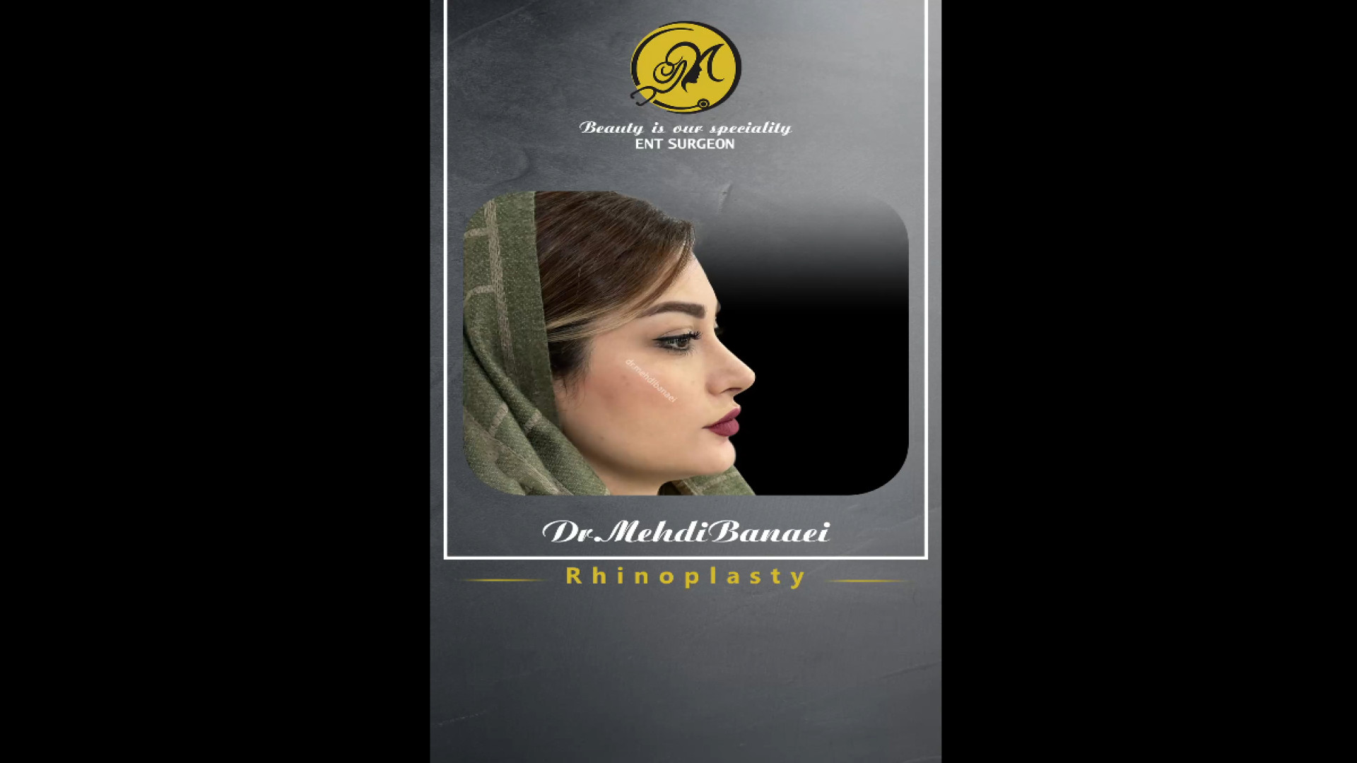 نگاهی به نتیجه عمل بینی
