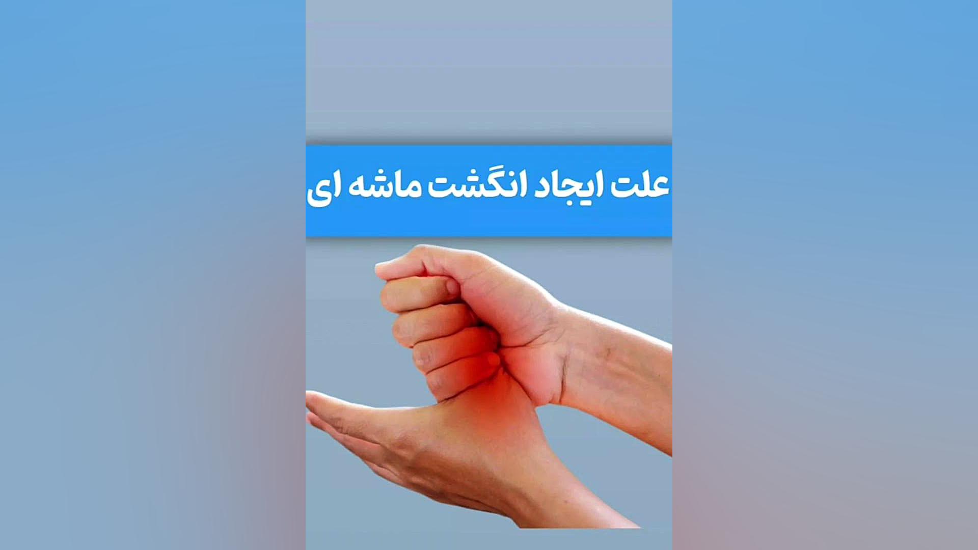 علت ایجاد انگشت ماشه ایی . کلینیک درد مهرگان لیفت پیشانی