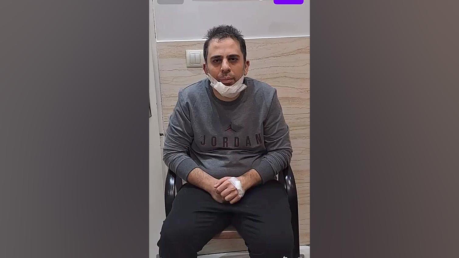 درمان عصب سه قلو . کلینیک درد مهرگان اتوپلاستی