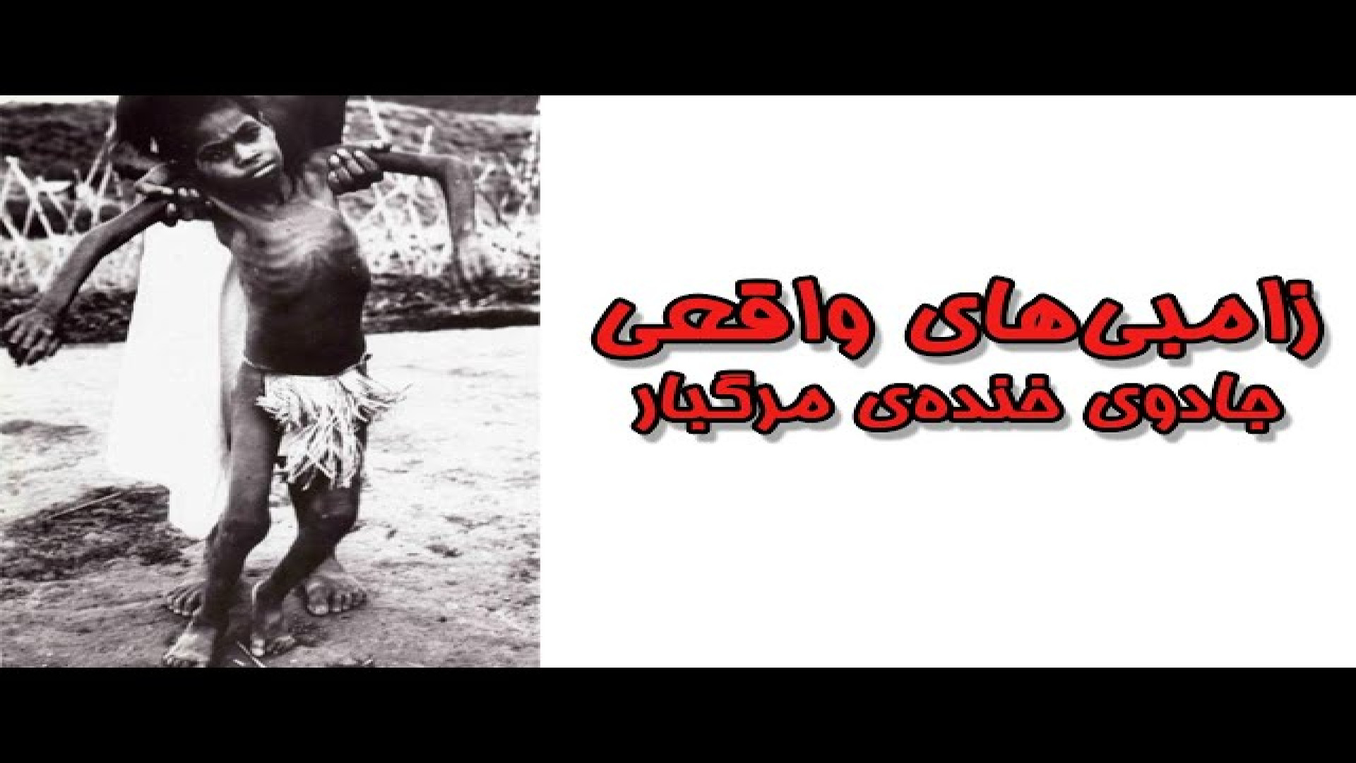 بررسی بیماری کورو بازیولوژی NET-Seq