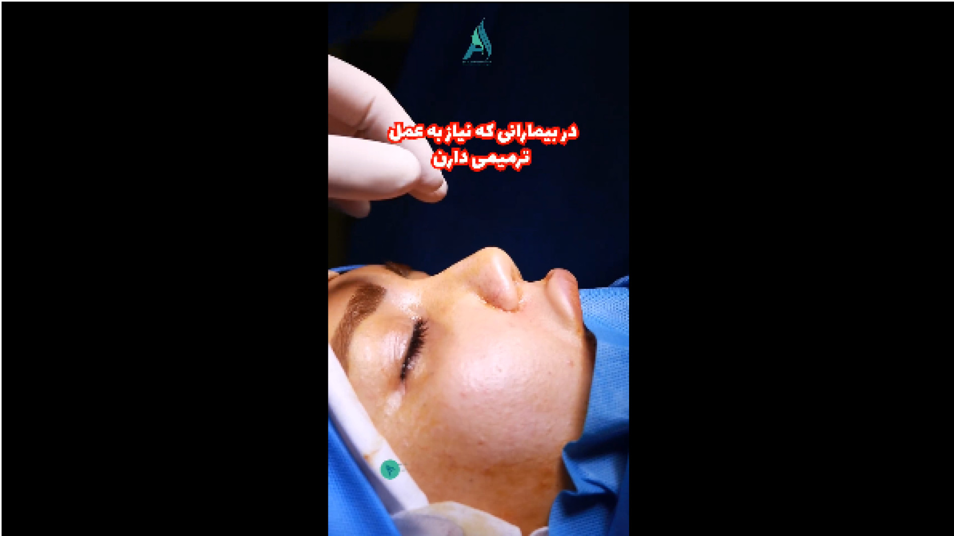 عمل بینی ترمیمی دکتر محمدرضا آخوندی نسب-فوق تخصص جراحی پلاستیک