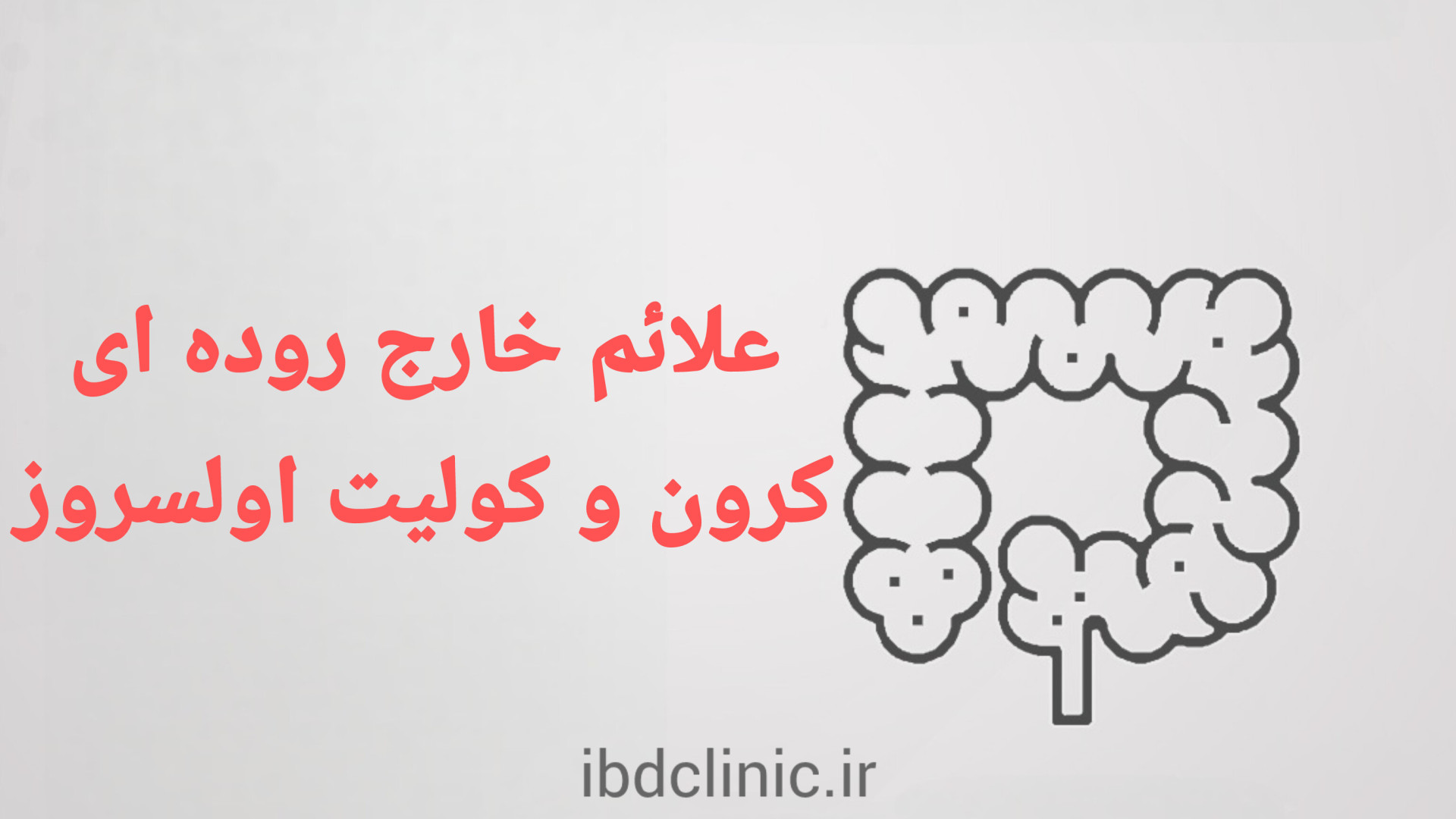 اپیزود سوم، تظاهرات خارج روده ای بیماری التهابی روده (کولیت اولسروز و کرون) دكتر عليرضا سيما