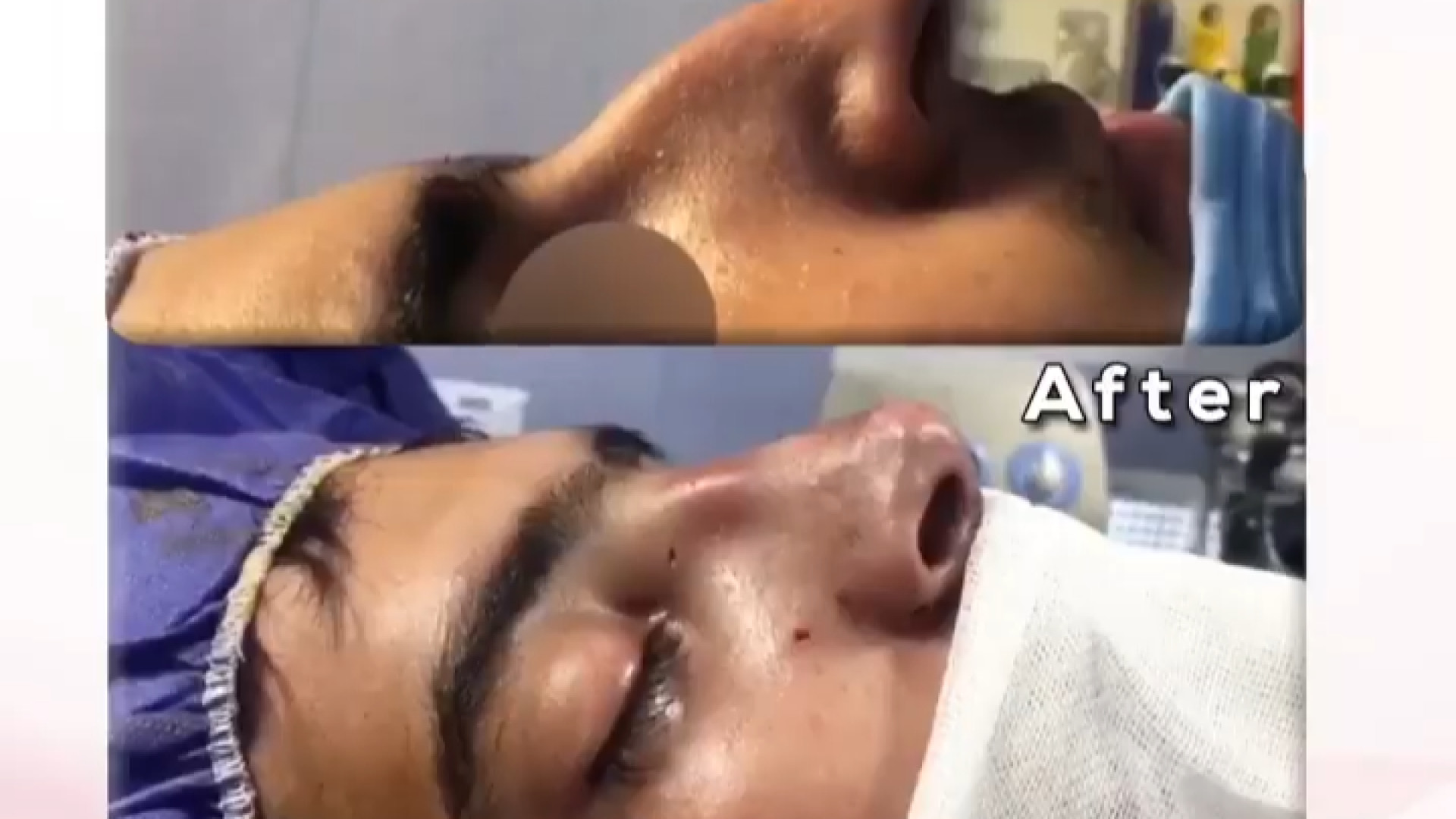 جراحی بینی دکتر مهدی قدیری