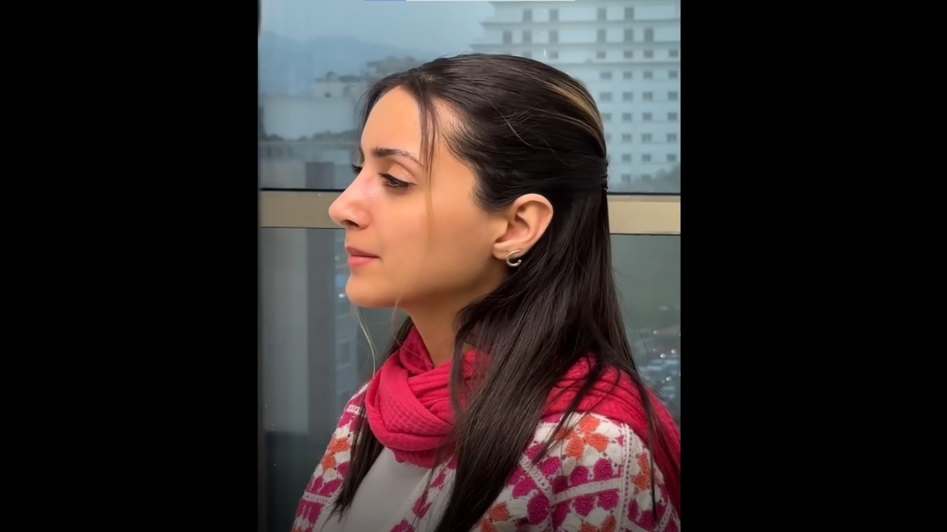 9 ماه بعد از جراحی بینی گوشتی خیلی بزرگ دکتر محمد مجیدی - جراحی بینی به سبک طبیعی شیک