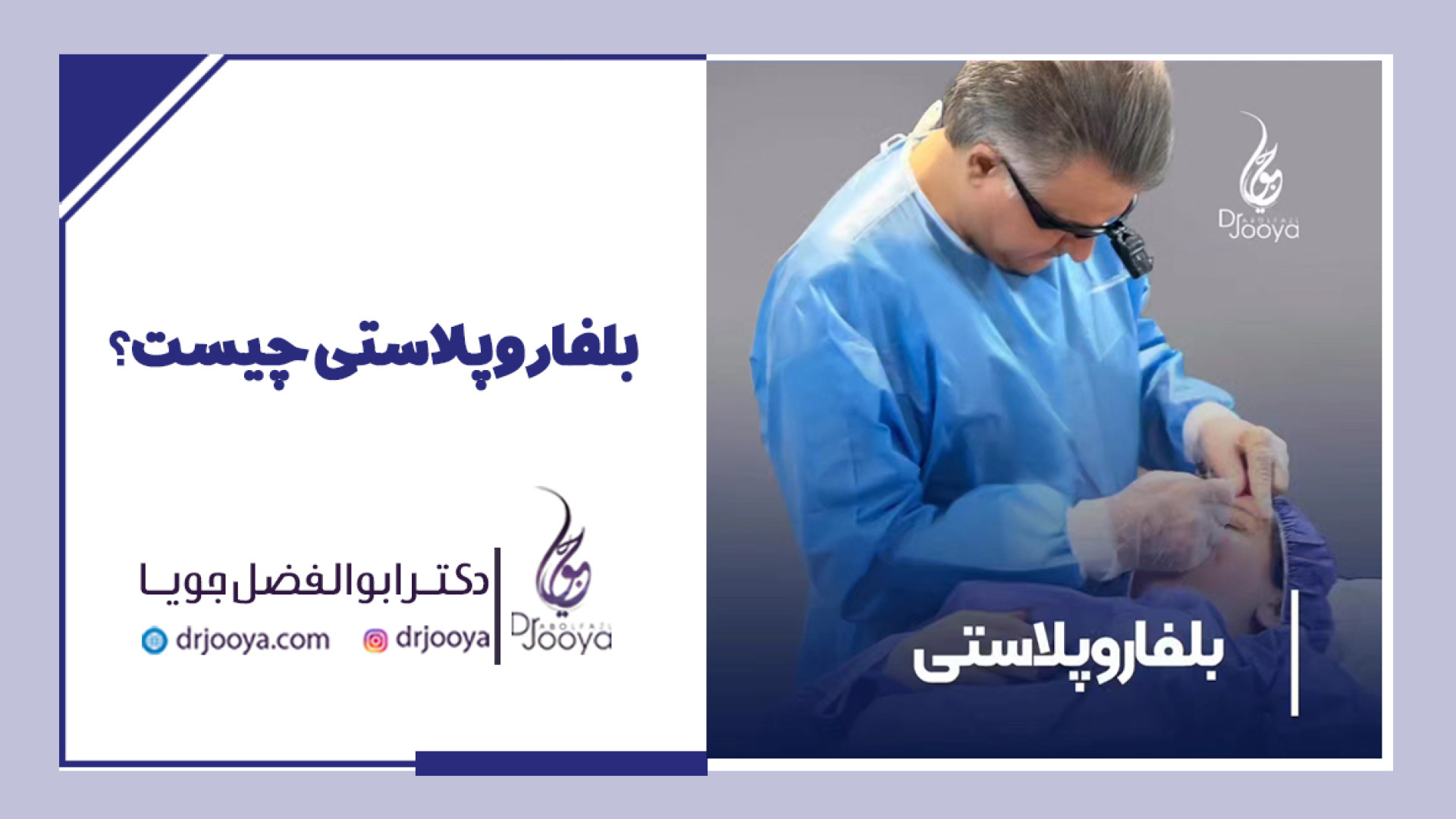 بلفاروپلاستی | بهترین متخصص پوست، مو، لیزر و زیبایی اصفهان دکتر ابوالفضل جویا