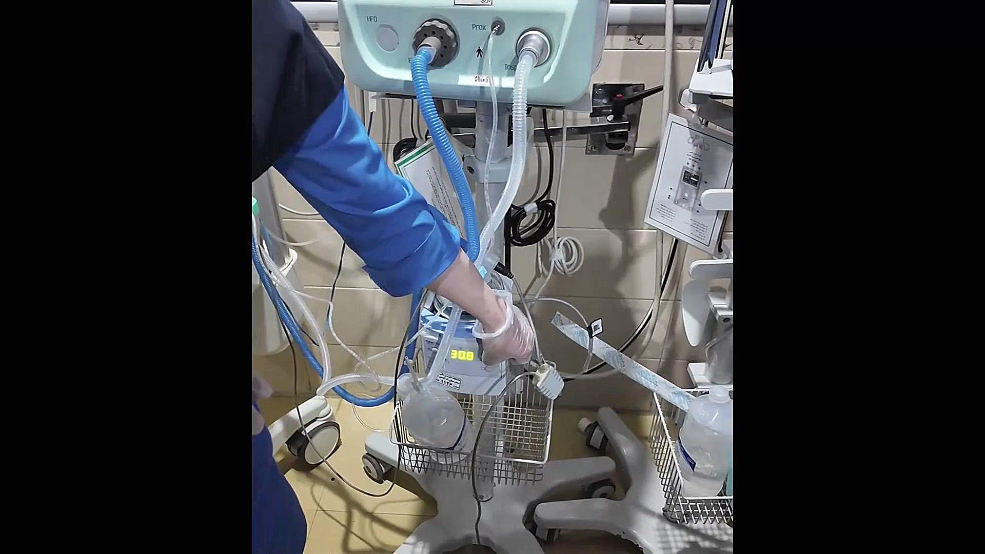 اگه گفتید اشکال تنظیم مرطوب کننده این ونتیلاتور چیه؟ پالپوتومی