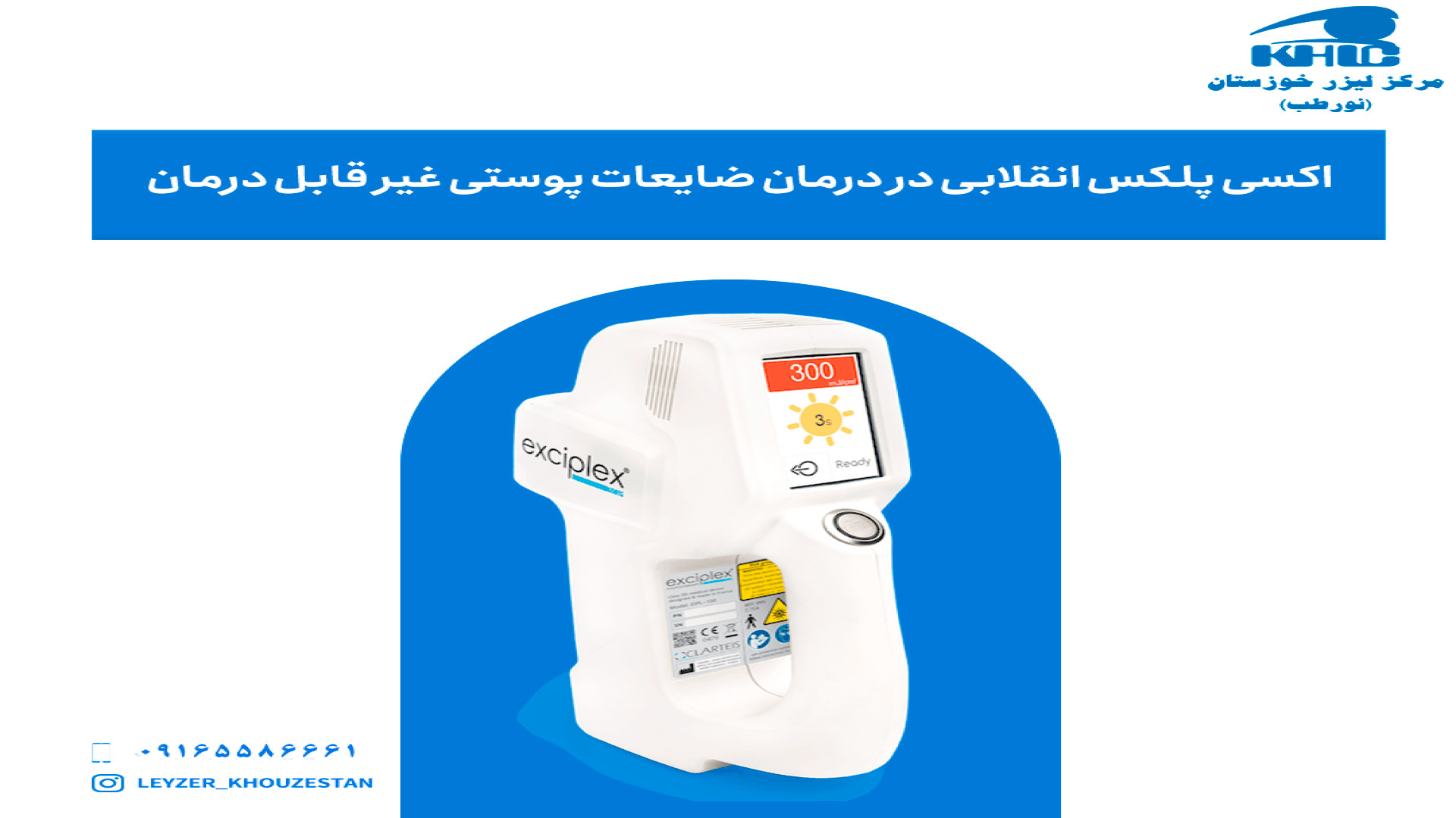 درمان ویتیلیگو با لیزر برای اولین بار در استان خوزستان با سرعت سه برابر جعفر خوشخواب