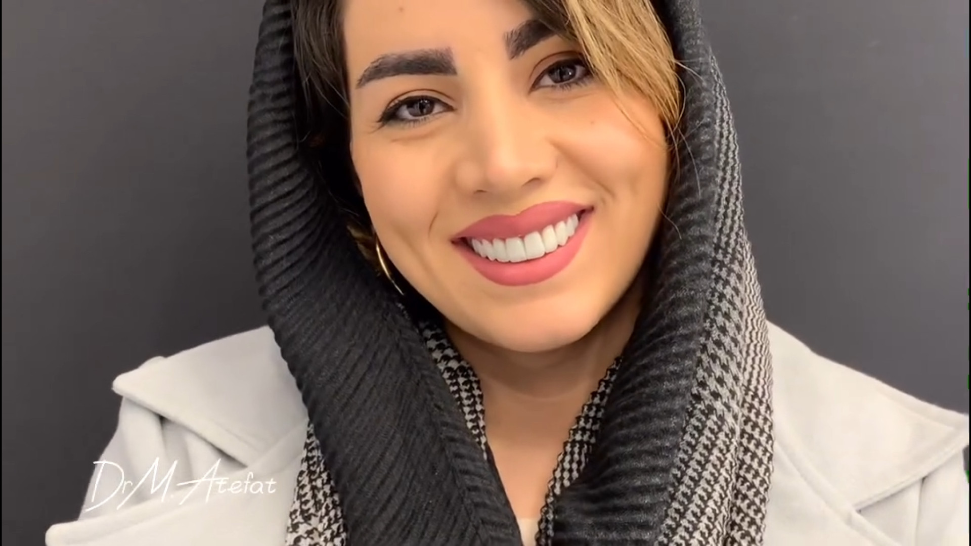 درمان ترکیبی ایمپلنت و روکش سرامیکی در اصفهان | دکتر محمد عاطفت دکتر محمد عاطفت متخصص ترمیمی و زیبایی اصفهان