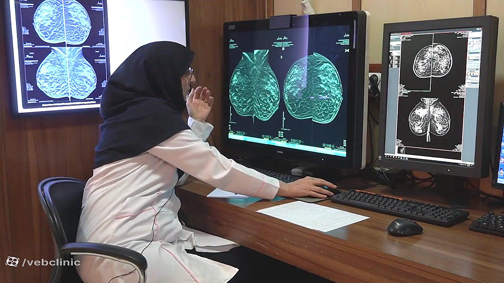 ماموگرافی سه بعدی در اصفهان فالو