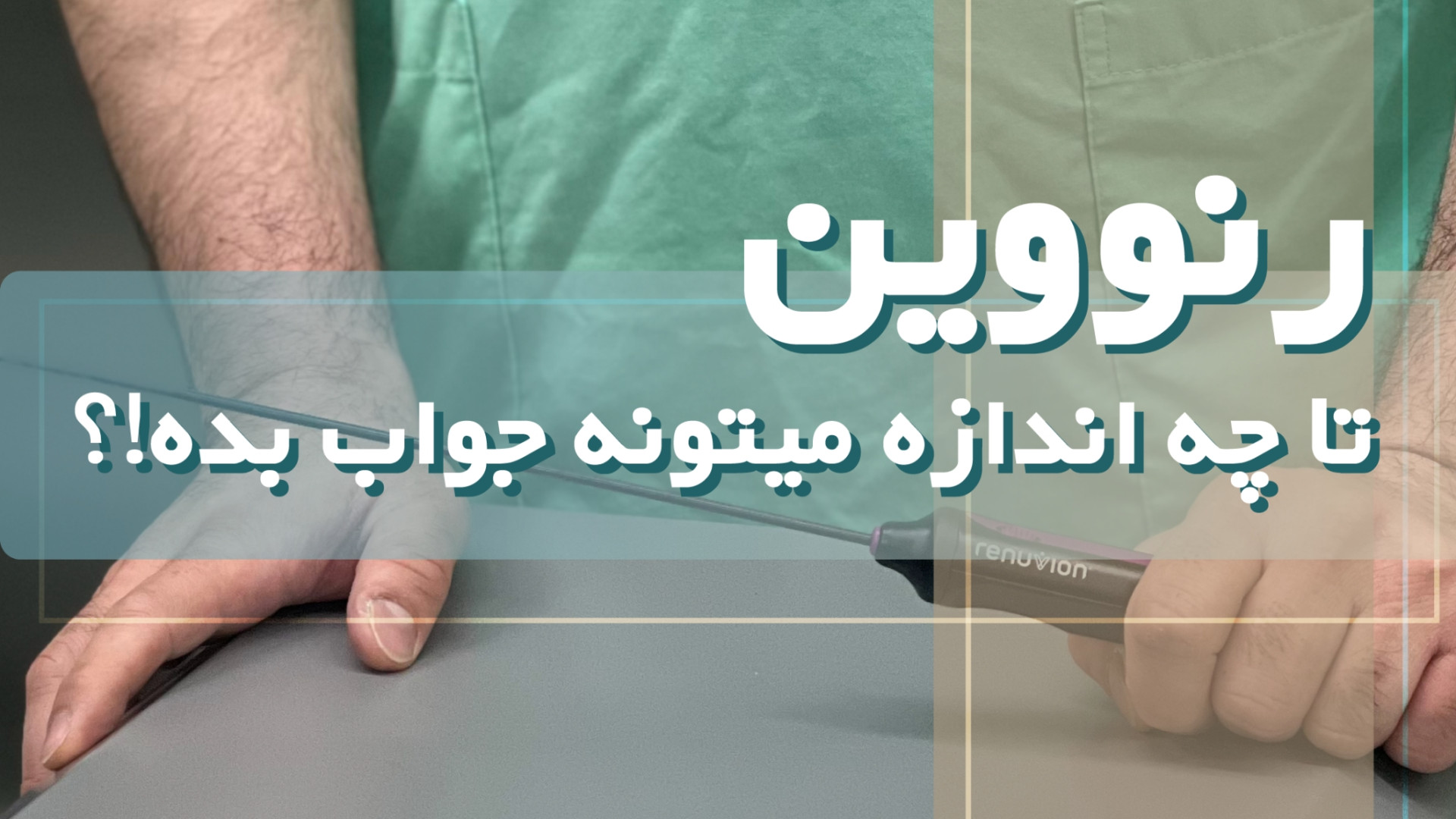 رنوویون تا چه اندازه میتونه جواب بده!؟ کمند امیرسلیمانی