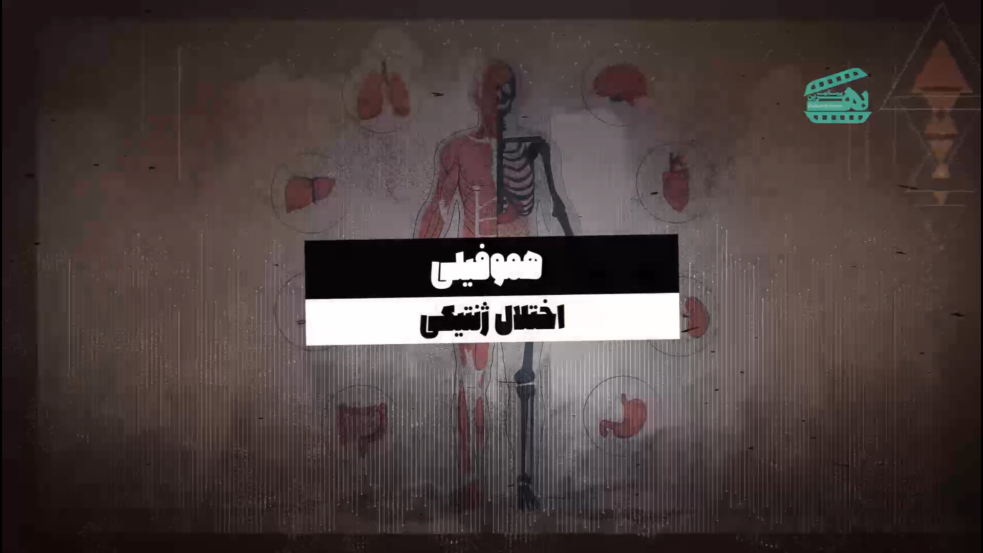 موشن گرافی بیماری هموفیلی کاشت ابرو