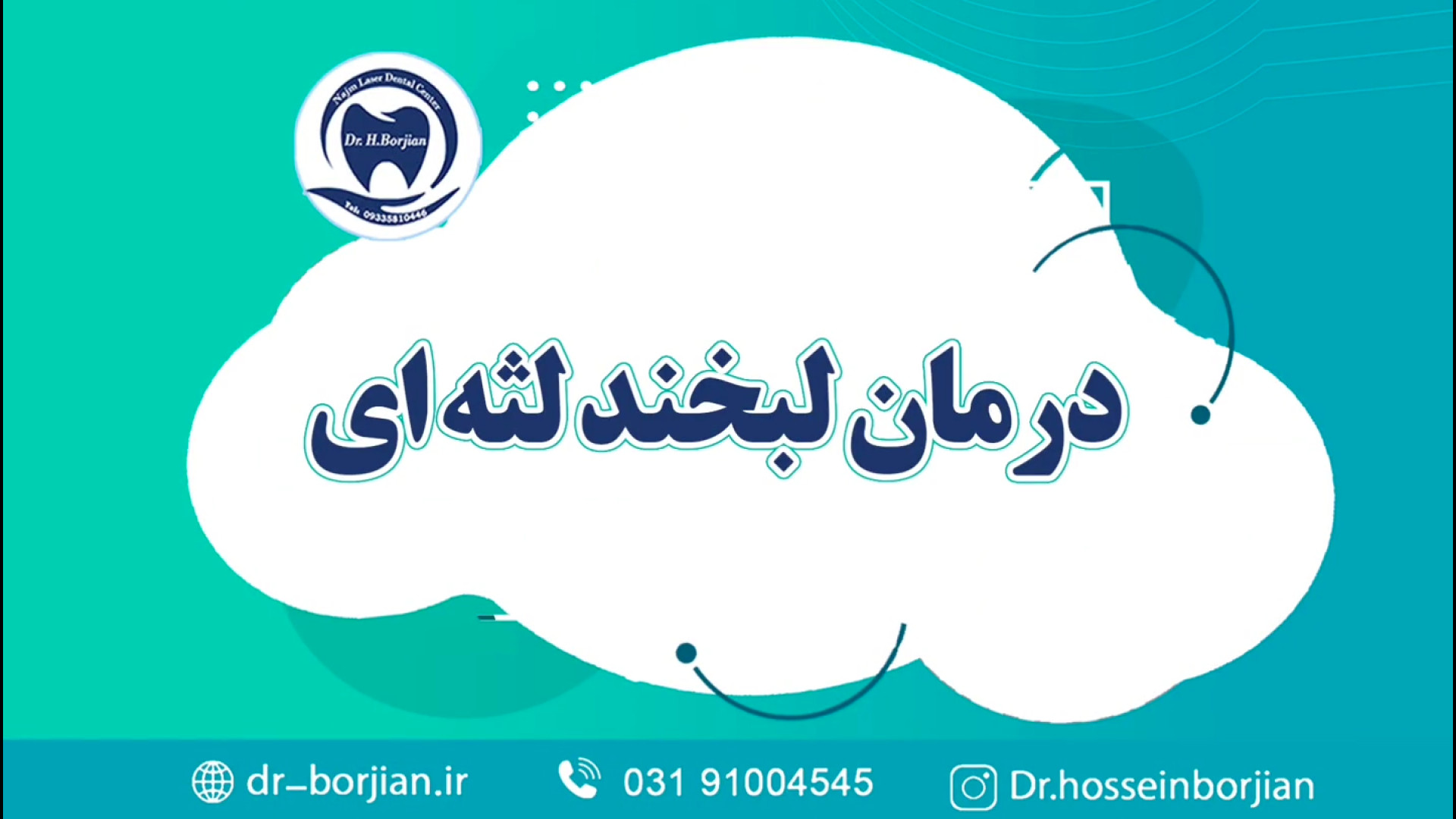 درمان لبخند لثه ای | بهترین جراح لثه اصفهان آنیسکوری
