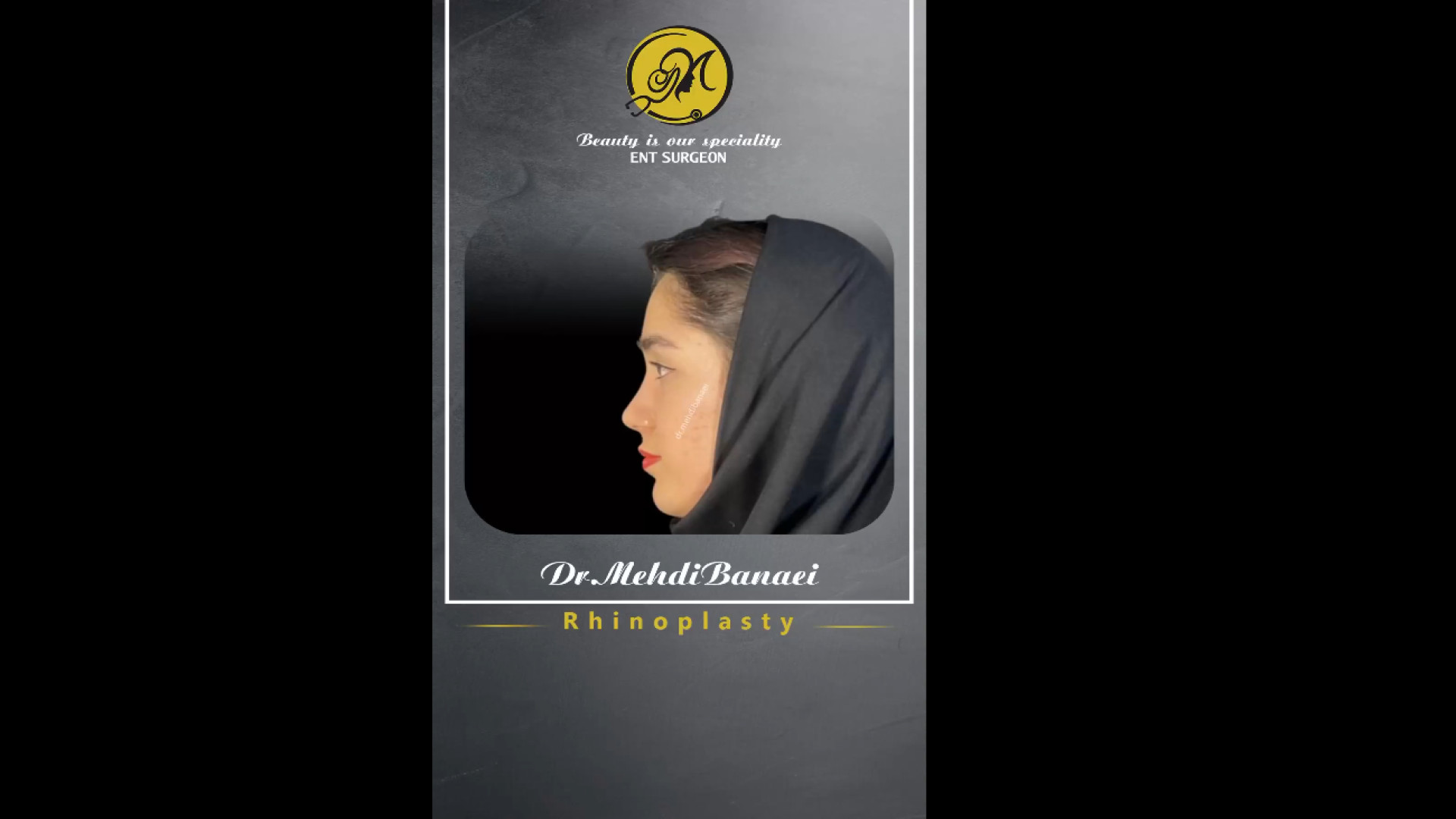 نتیجه جراحی بینی