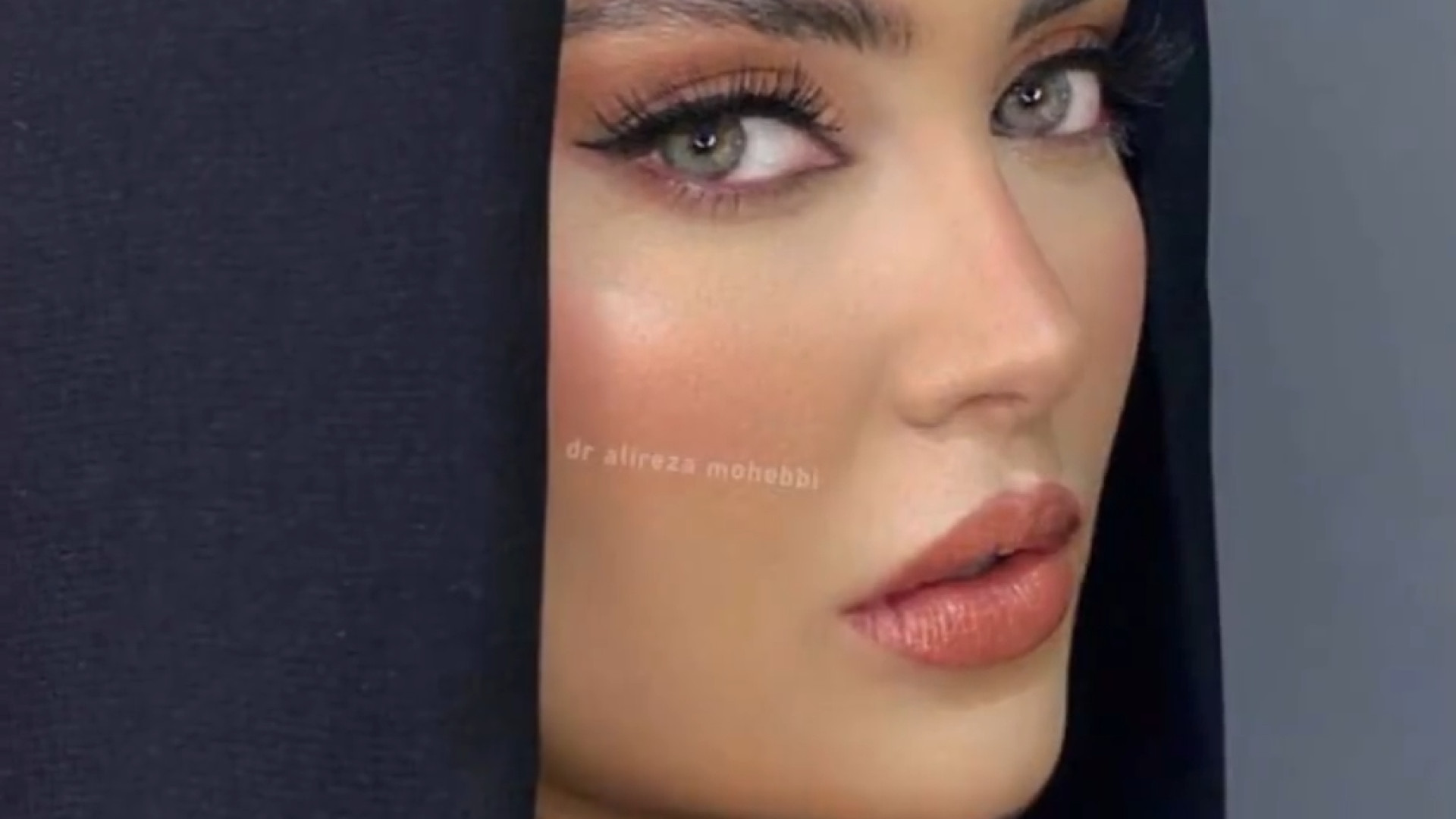 نتیجه ده سال بعد از جراحی زيبایی بینی