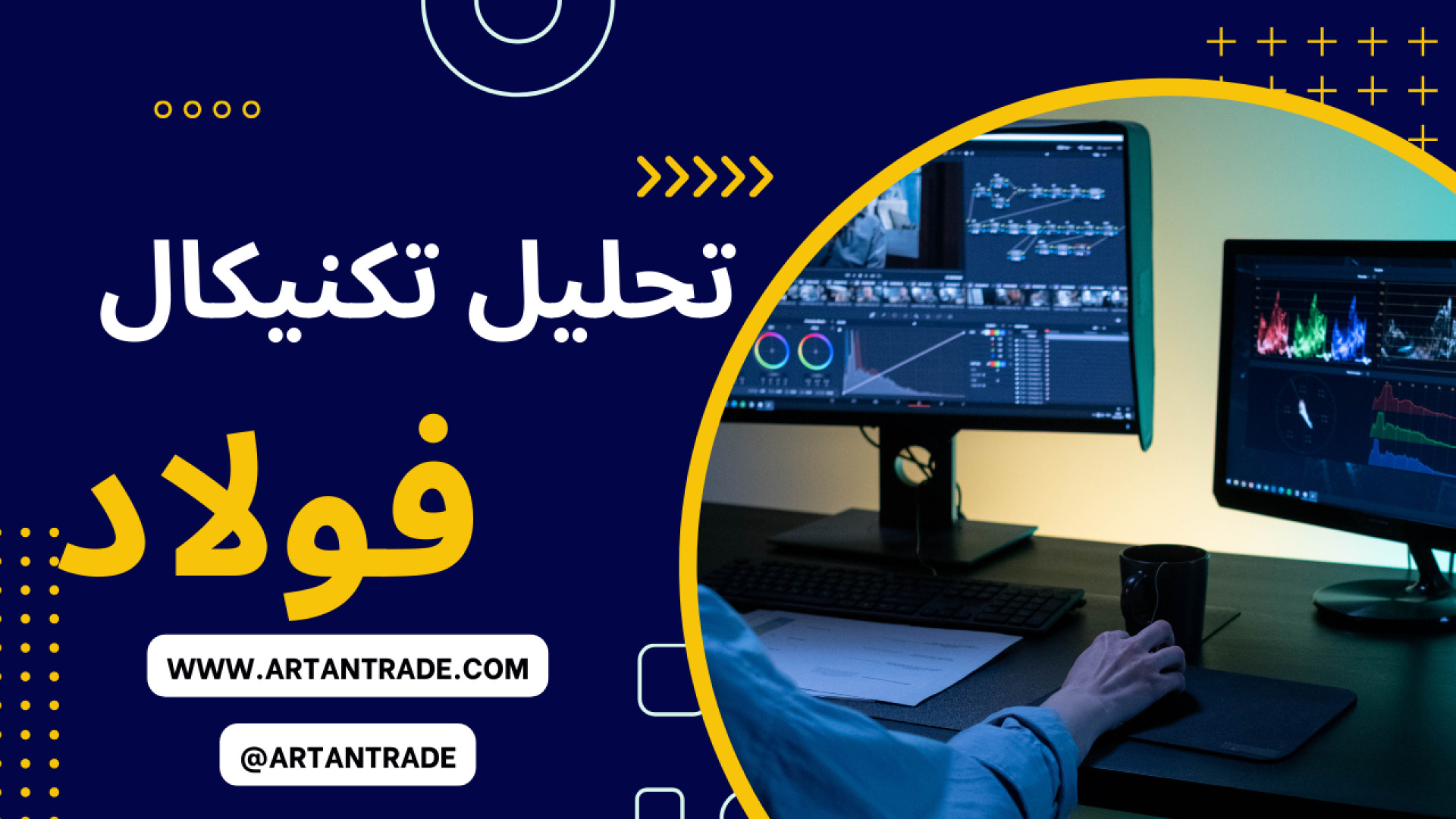 تحلیل تکنیکال فولاد بیماری گلوکوزامینوگلیکان تجمعی