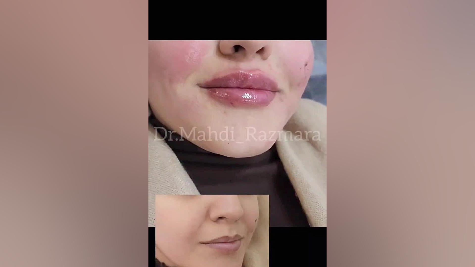 دکتر مهدی رزم آرا دکتر پوست مشهد | سایت بهترین در مشهد دستگاه فیبر نوری جراحی
