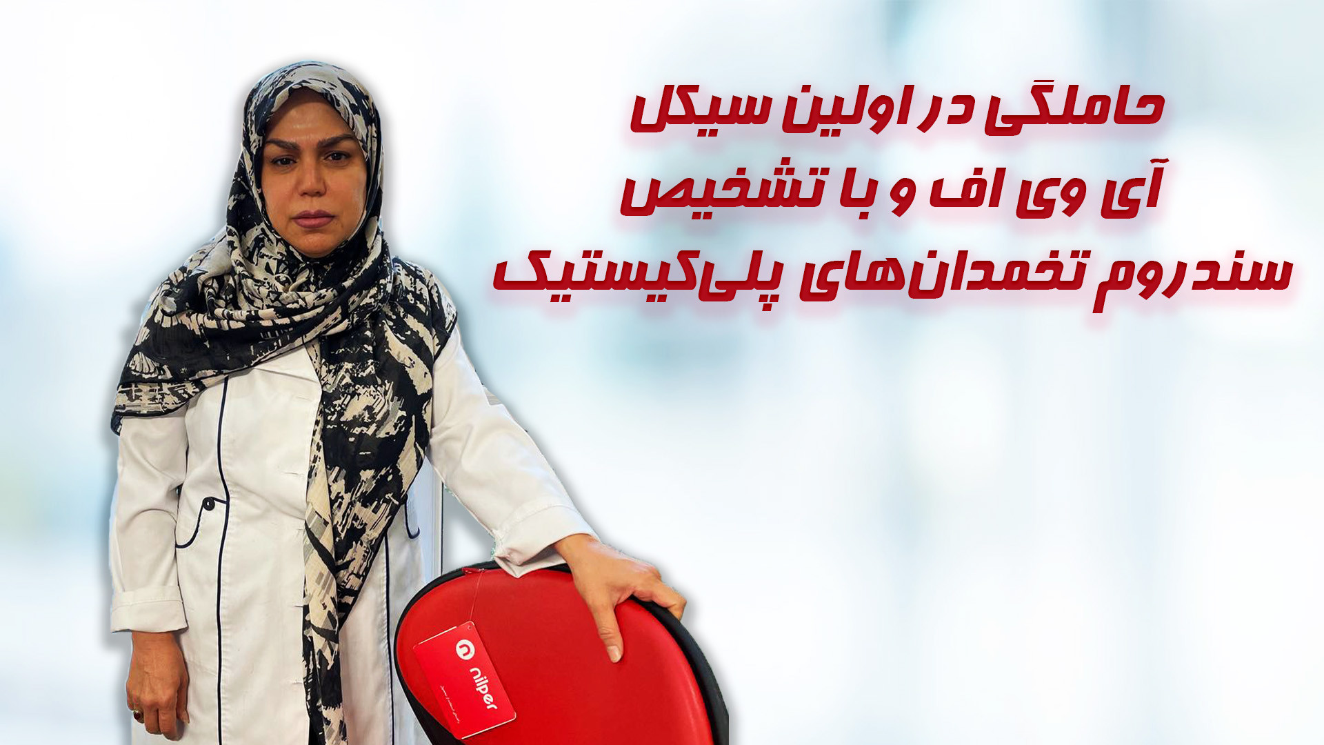 حاملگی در اولین سیکل آی وی اف و با تشخیص سندروم تخمدان‌های پلی‌کیستیک سندرم چیلبلینز