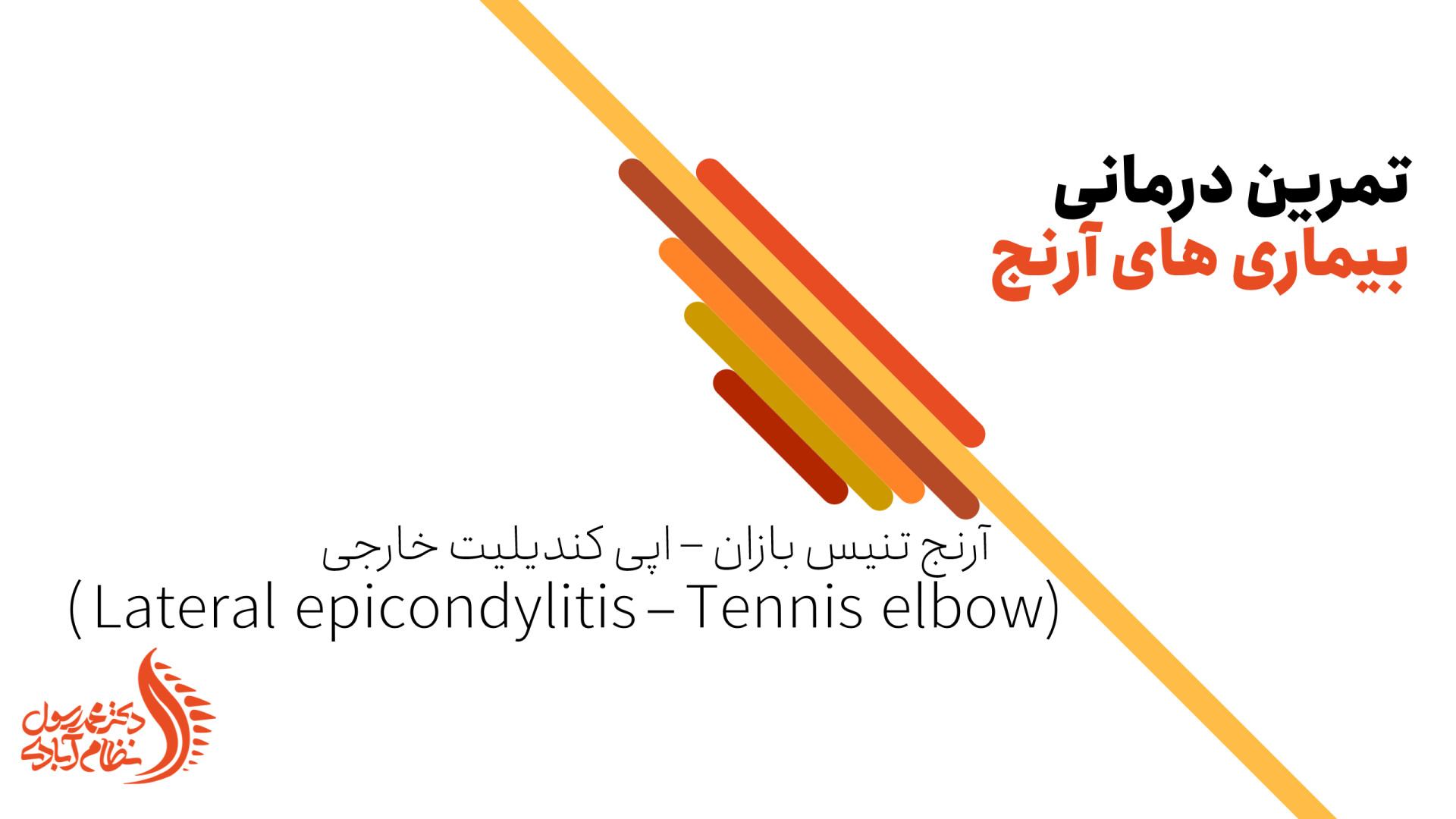 درمان آرنج تنیس بازان (اپی کوندیلیت خارجی) با تمرینات ورزشی دکتر محمد رسول نظام آبادی (فلوشیپ ستون فقرات)